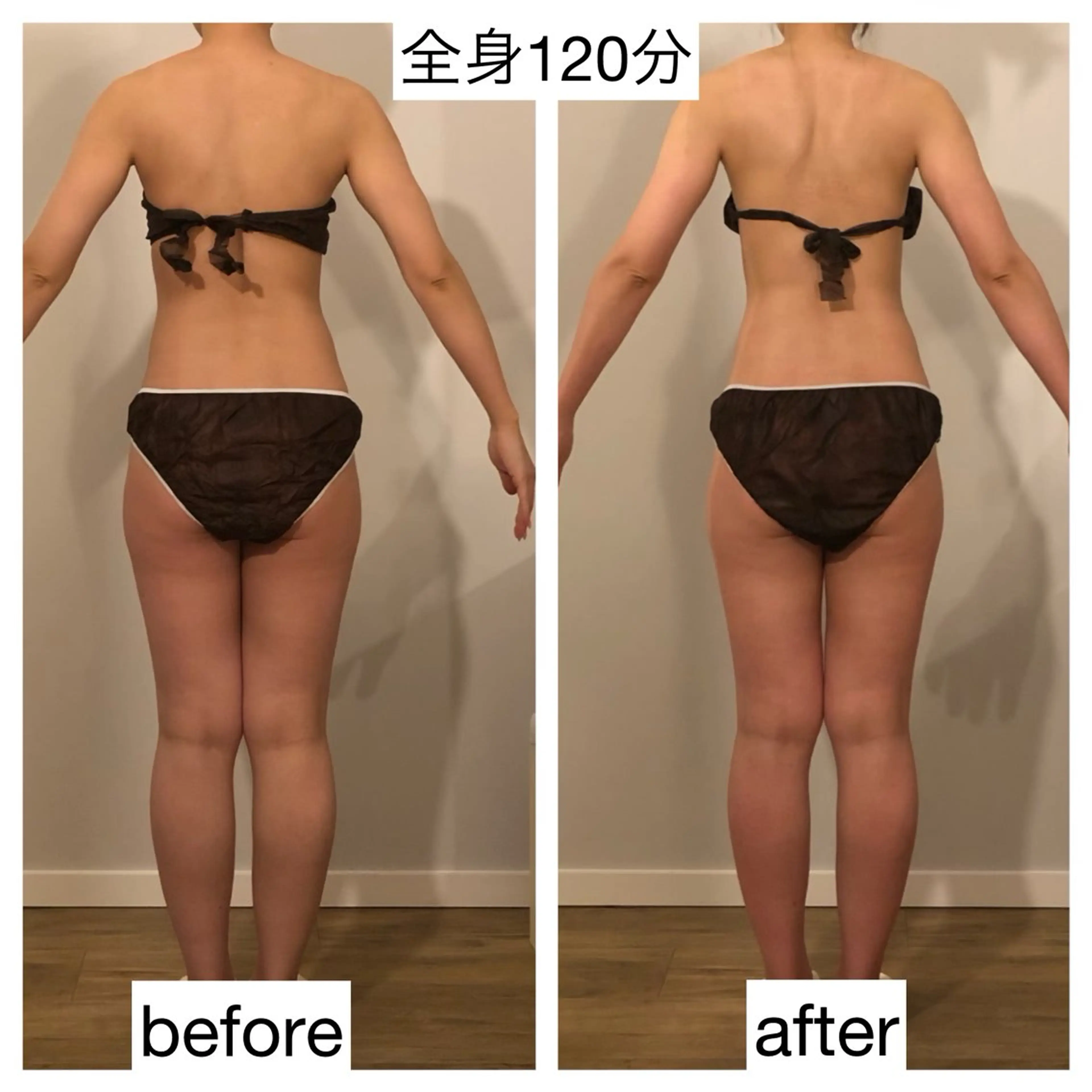 小顔・痩身専門店 Sunao所属・小顔.足痩せ整体 痩身天六Sunaoのその他イメージ