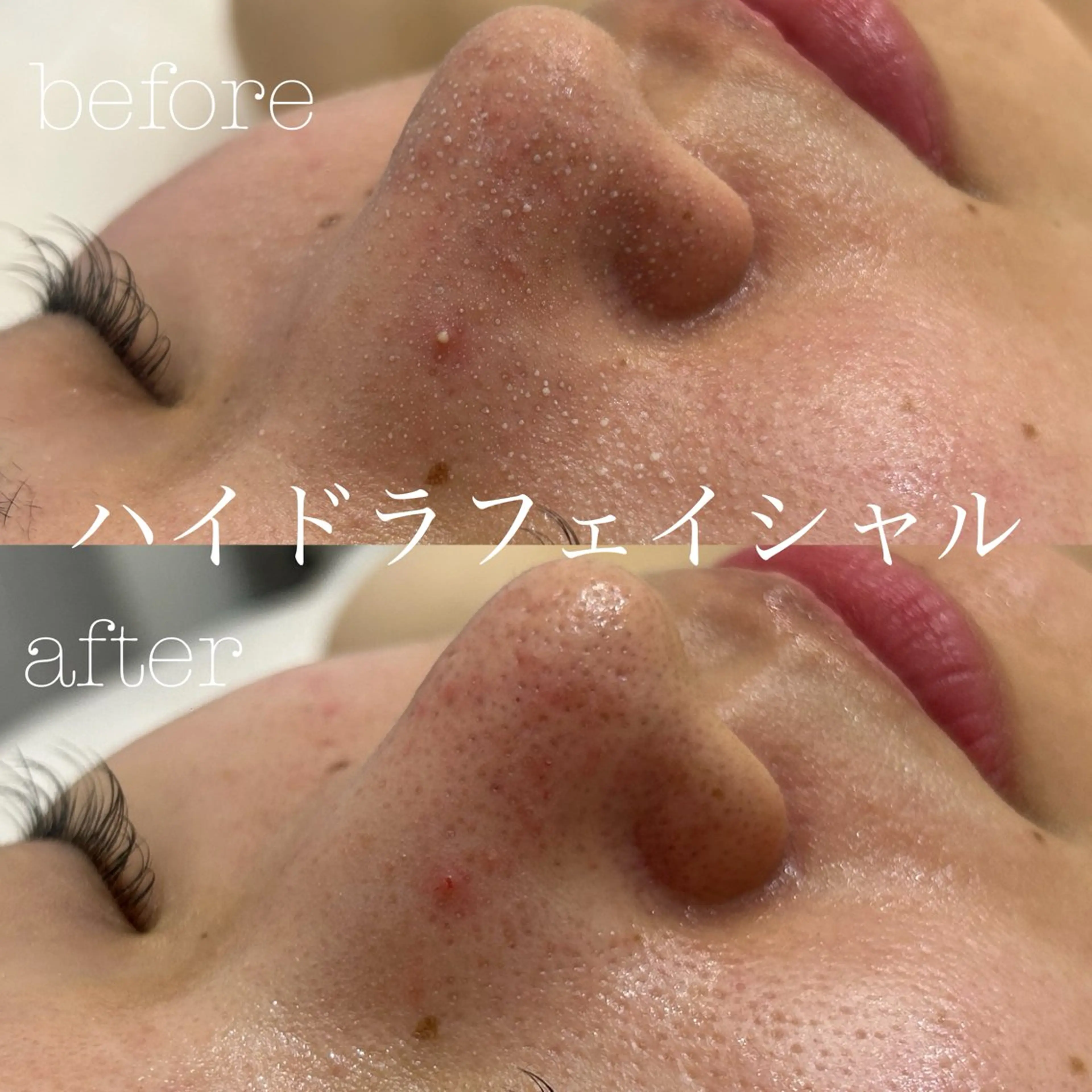 エステ フェイシャルサロン CHIARA 荒田のエステ・リラクイメージ