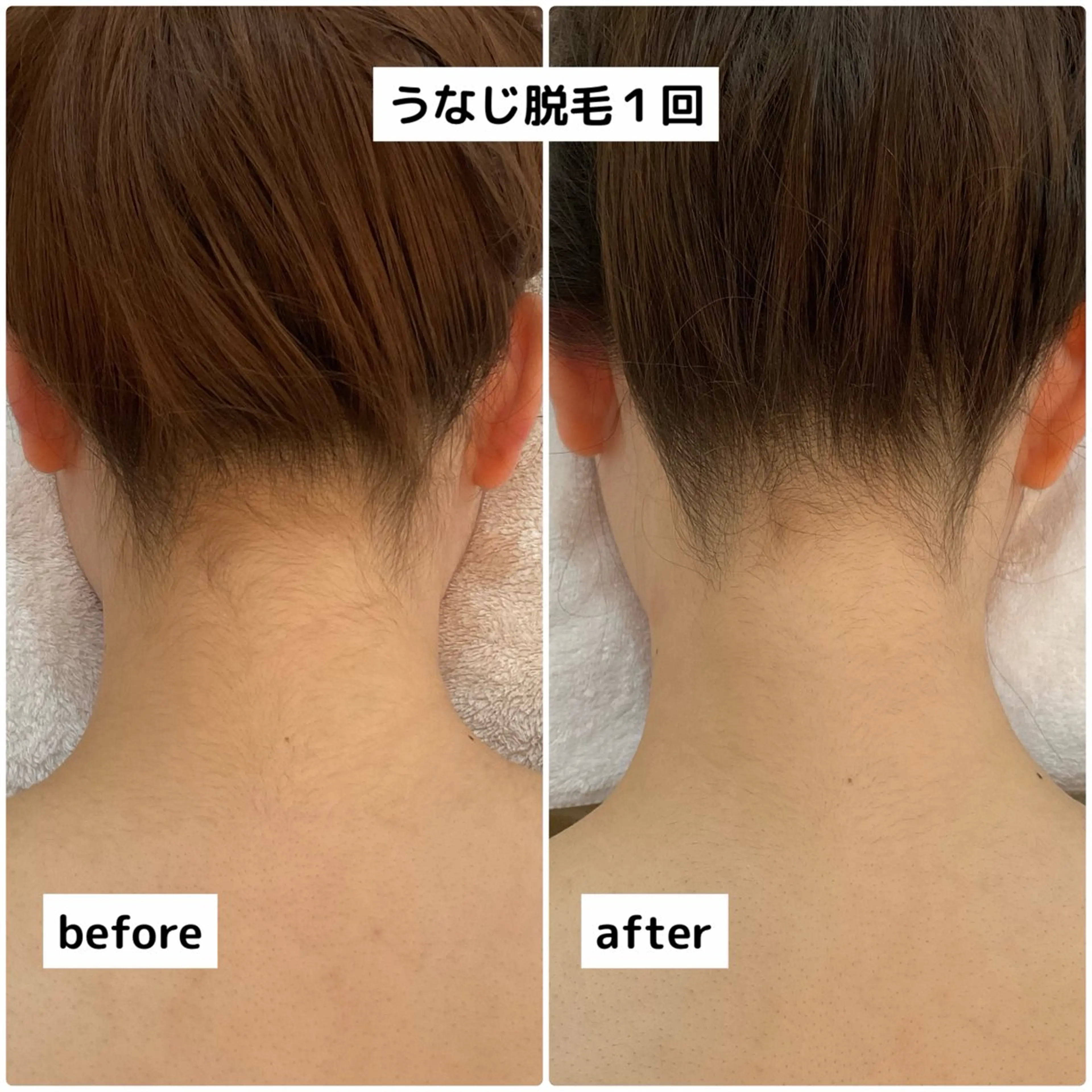 脱毛 PREVER プレヴェールのエステ・リラクイメージ