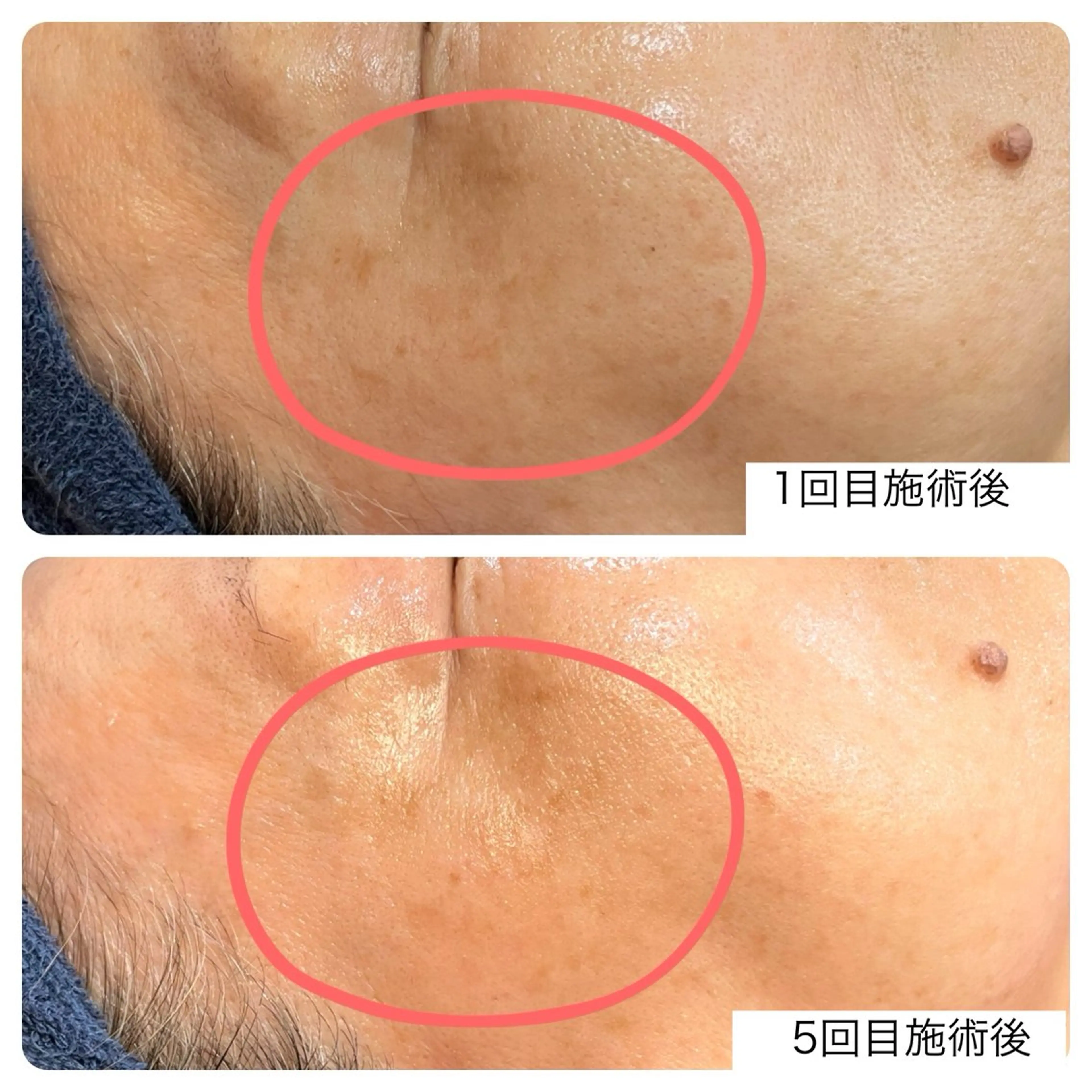 エステ leolo武蔵浦和 肌質改善＆脱毛のエステ・リラクイメージ