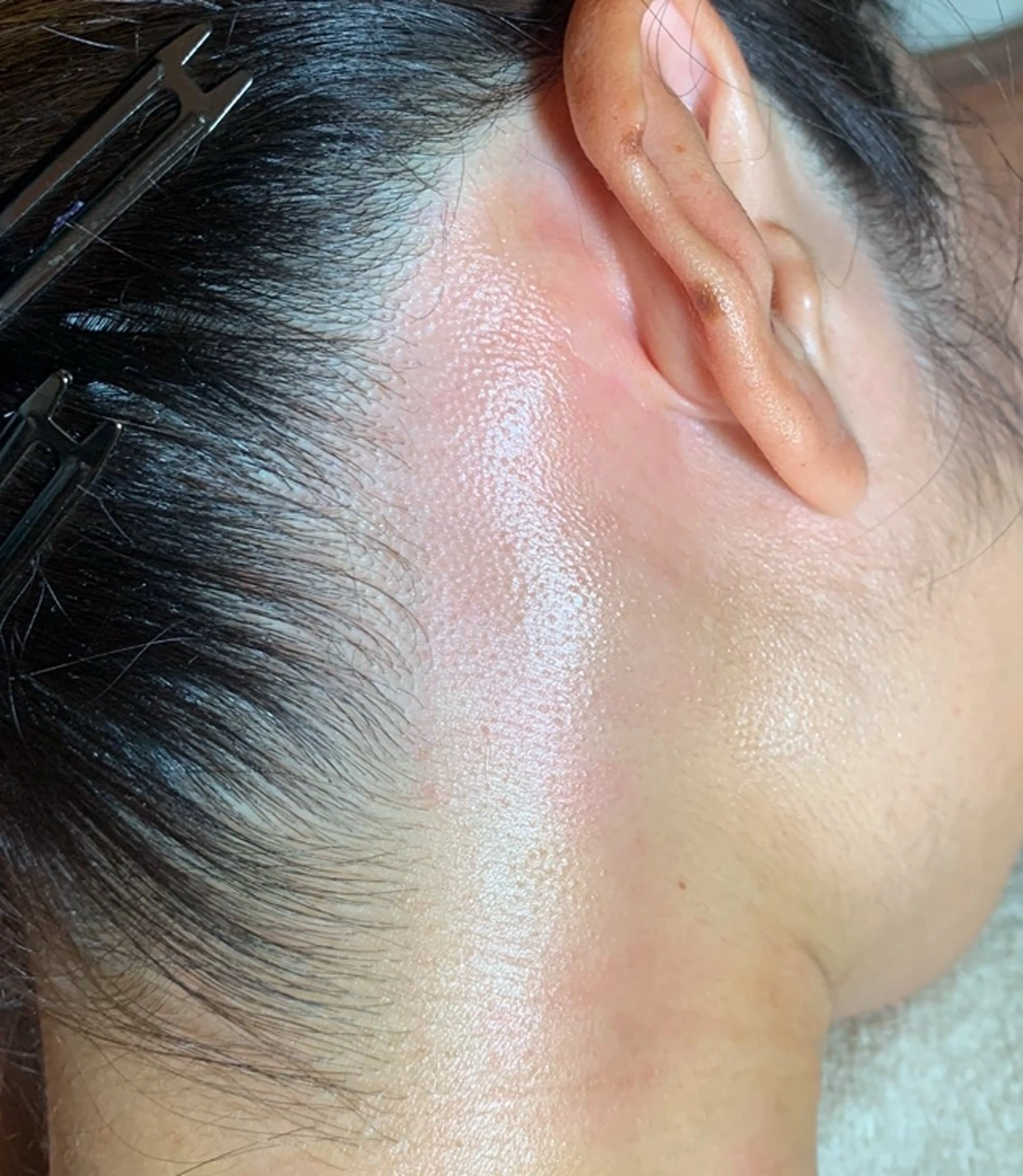 脱毛 Juri Ogawaのエステ・リラクイメージ