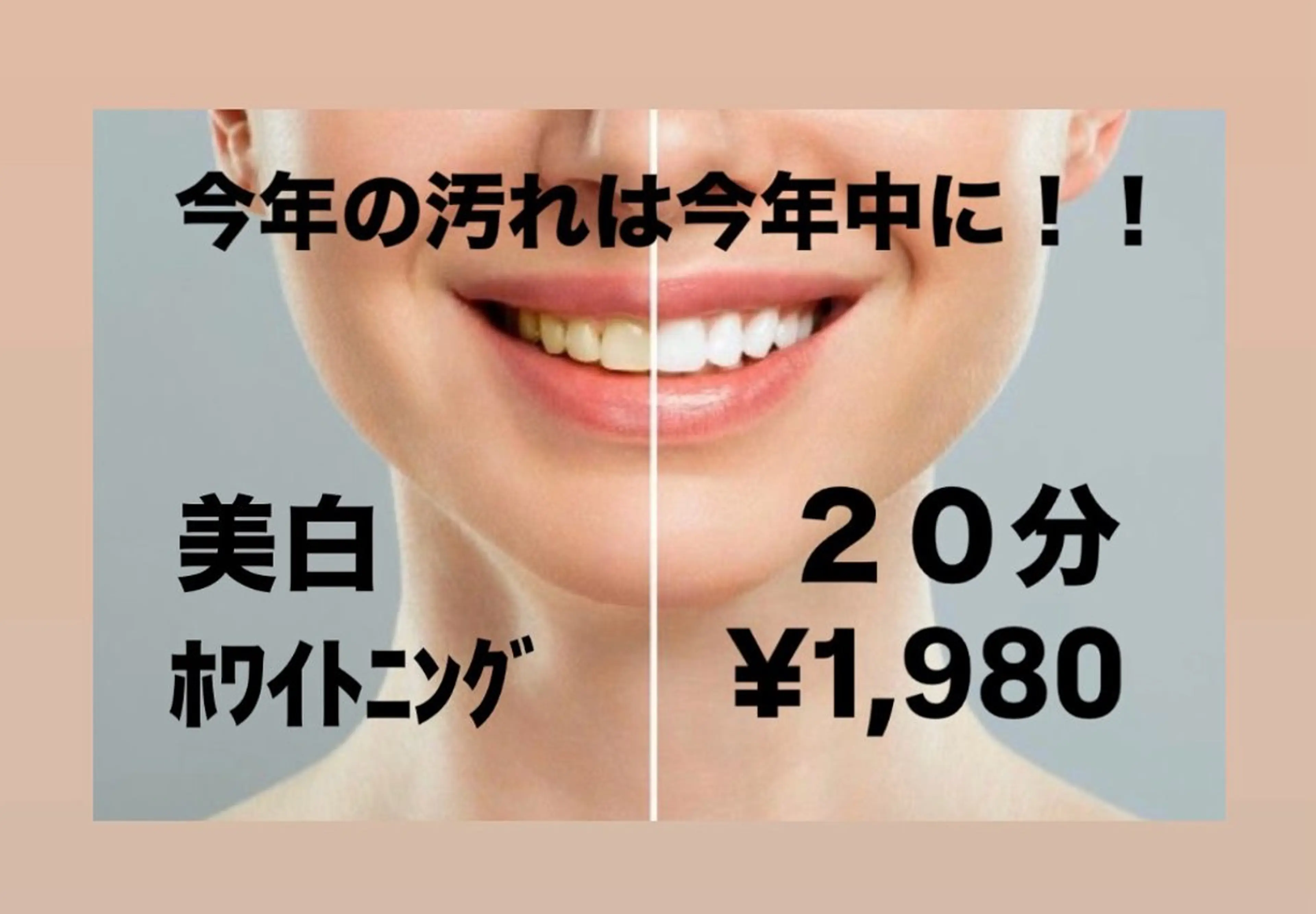 その他 【歯のホワイトニング専門店】シロエラボ梅田店所属・シロエラボ 梅田店のその他イメージ
