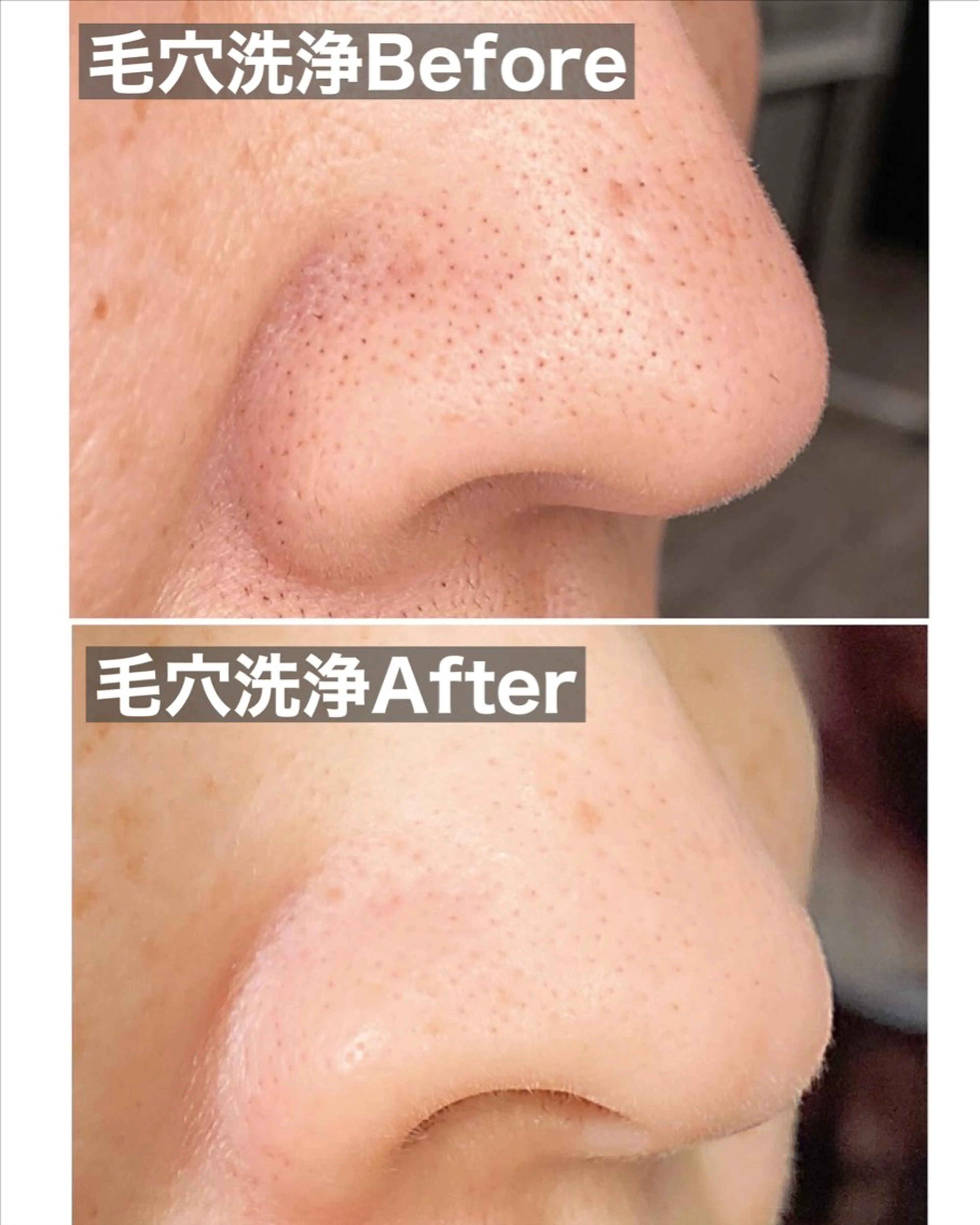 エステ メディカルサロンドオフ所属・ハリサロンドオフ 美容鍼灸×小顔整体のエステ・リラクイメージ