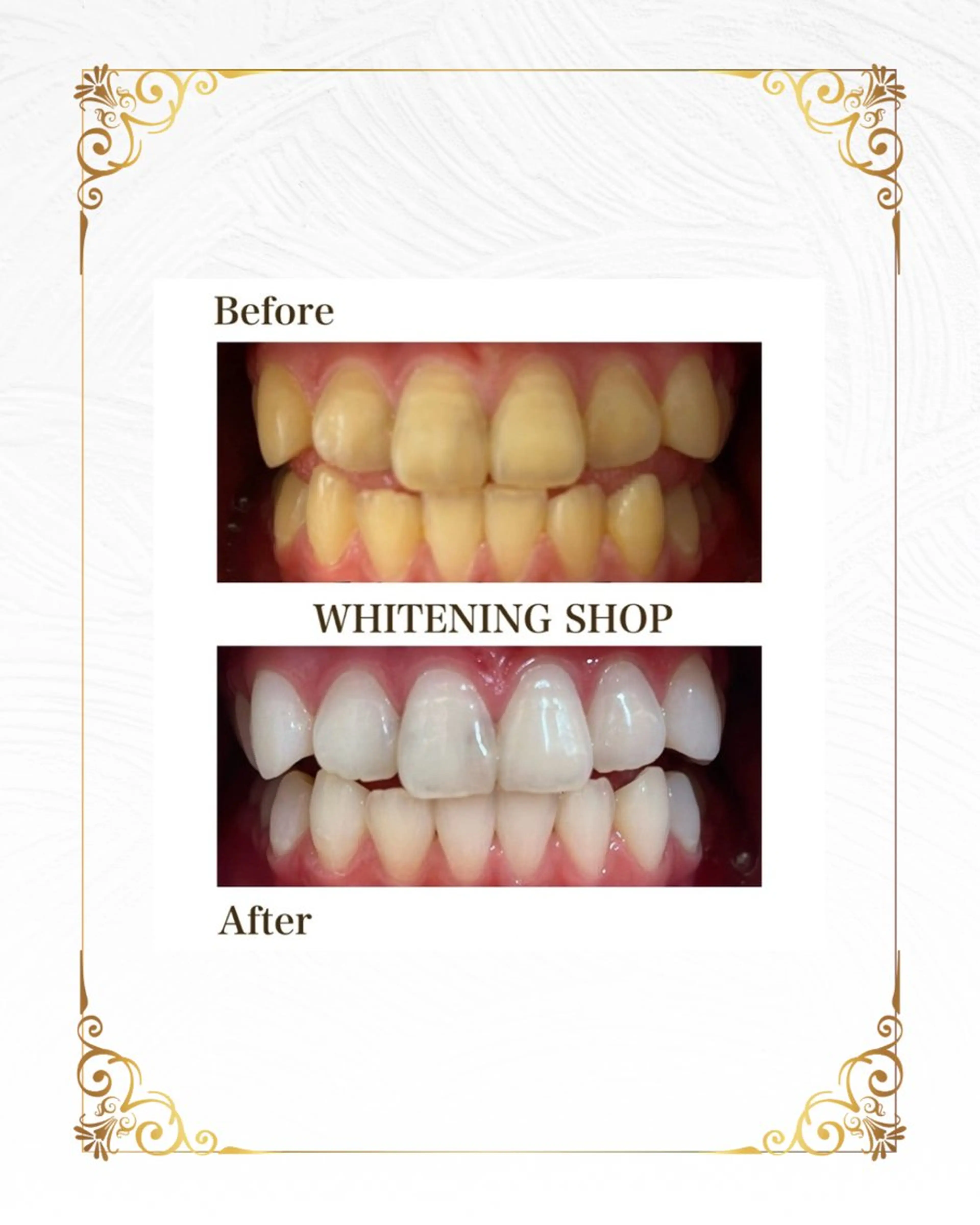 ホワイトニングショップ静岡葵区店所属・ホワイトニング ショップ葵区静岡駅店のその他イメージ