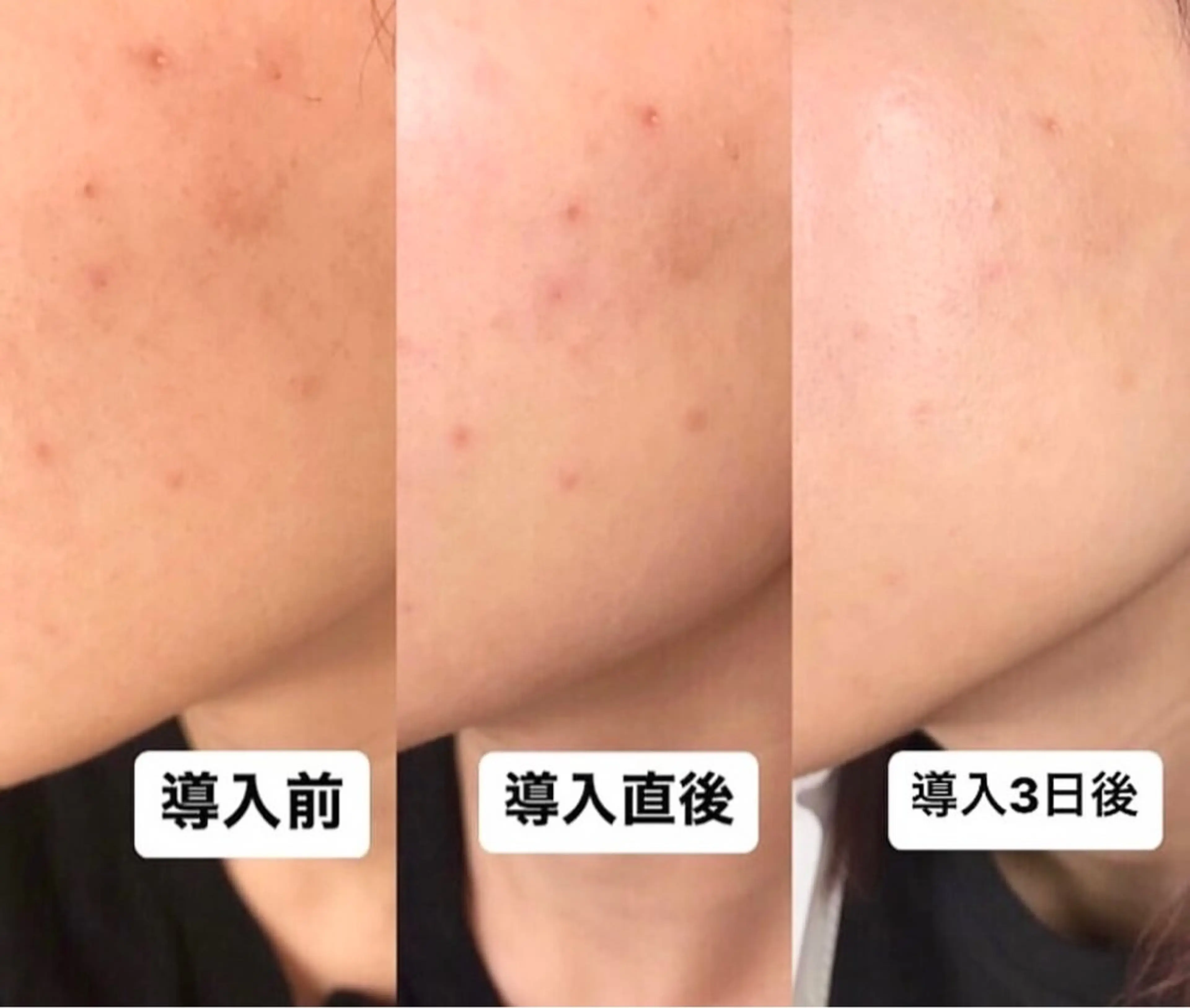 アイラッシュ&エステサロンLinda西宮所属・小顔&毛穴・肌質改善 LINDA西宮 AIのエステ・リラクイメージ