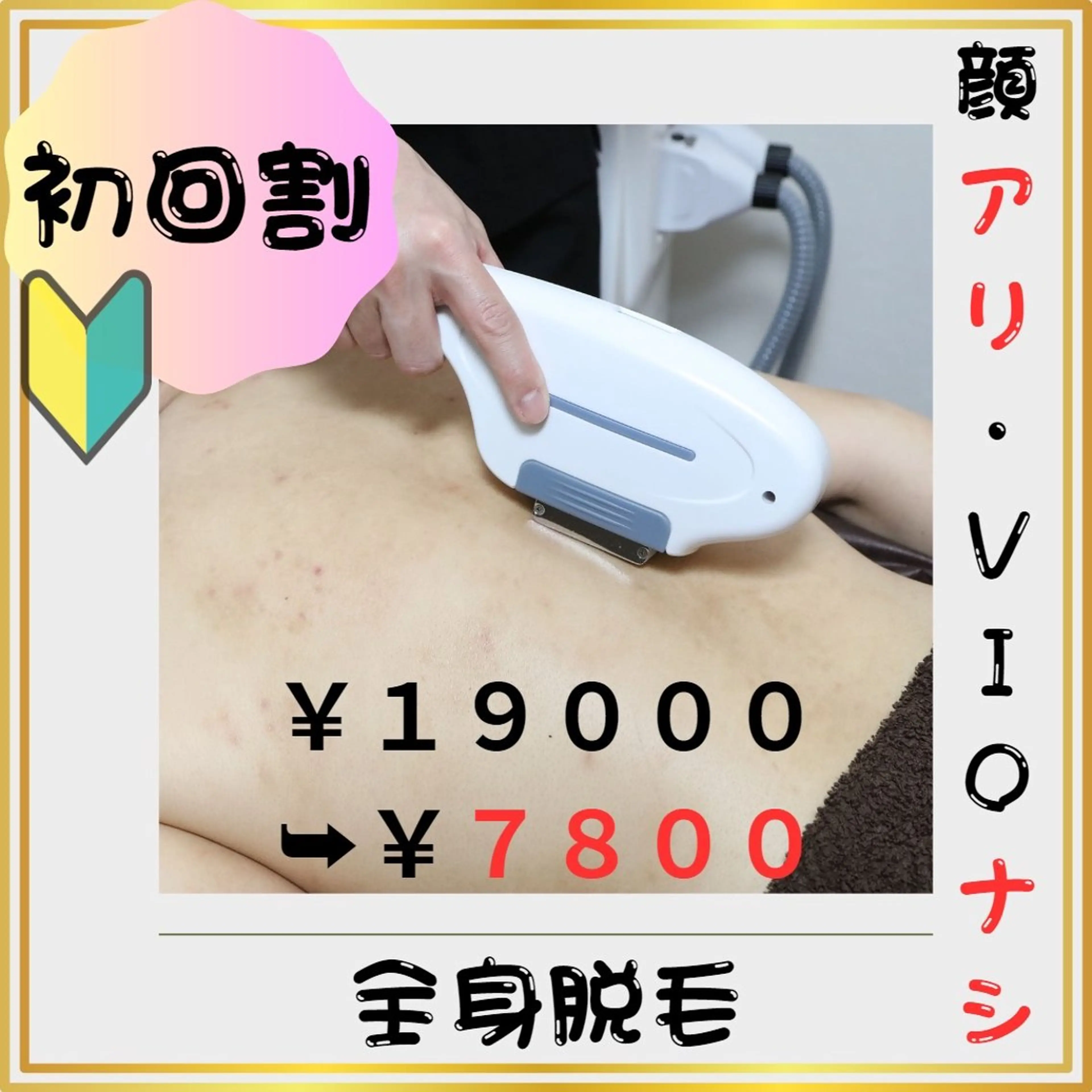 🔰新規割🔰【全身脱毛（顔有・VIO無）】 5️⃣9️⃣%割引❗️(#メンズ脱毛 　#第一印象UP  #都度払い)の写真