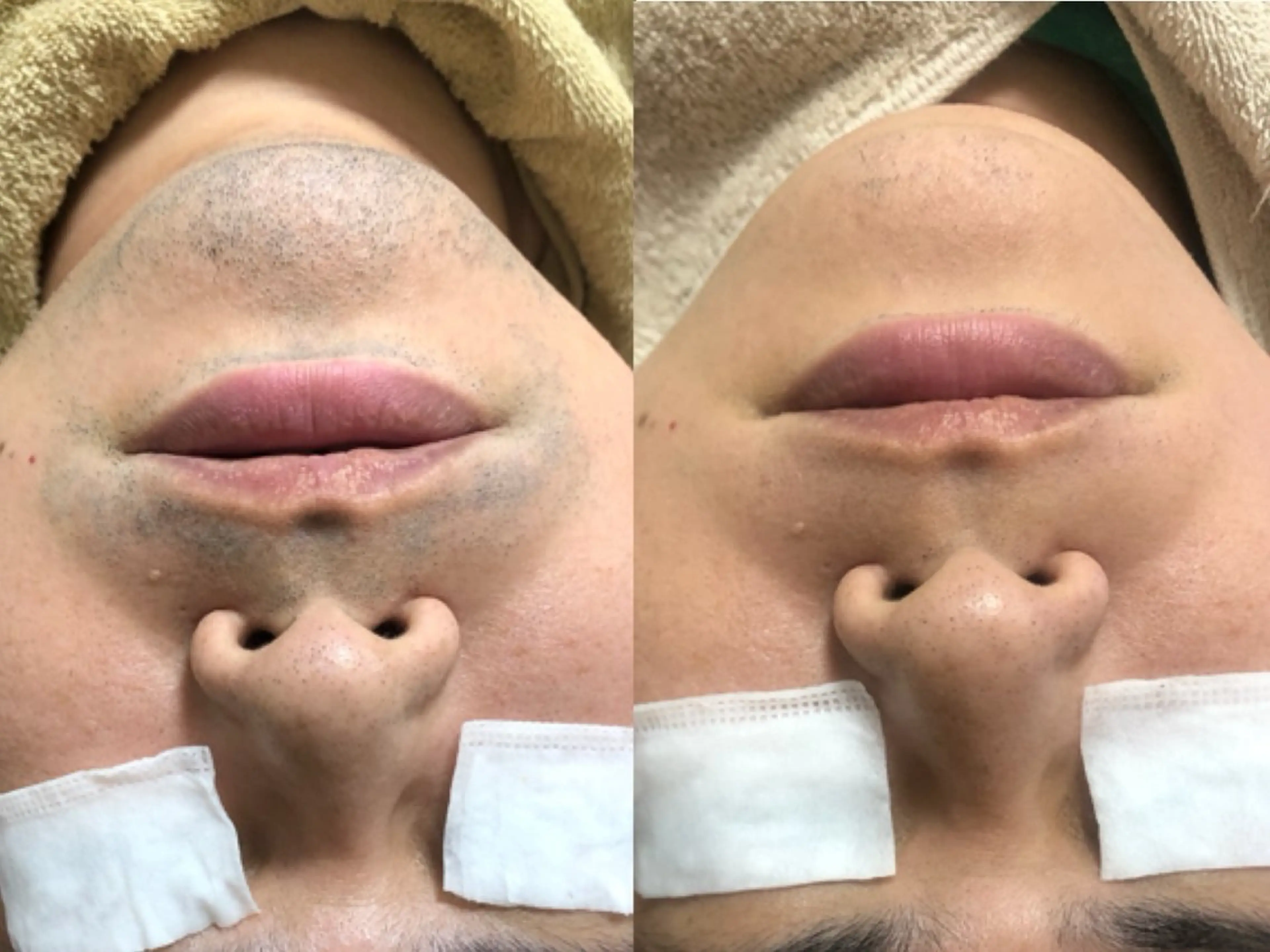 LANA所属・エステサロン LANA.のエステ・リラクイメージ