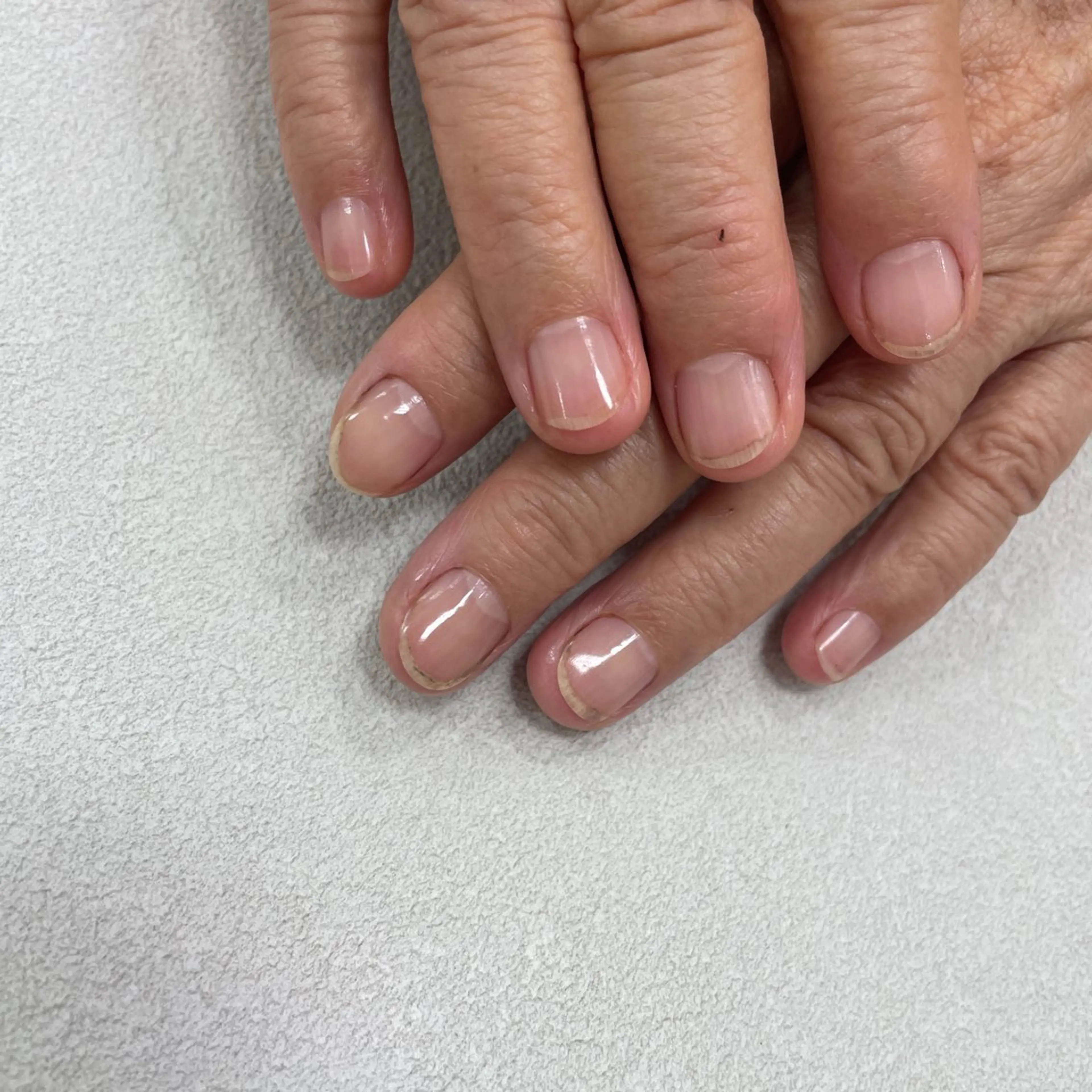 ハンドケアの写真