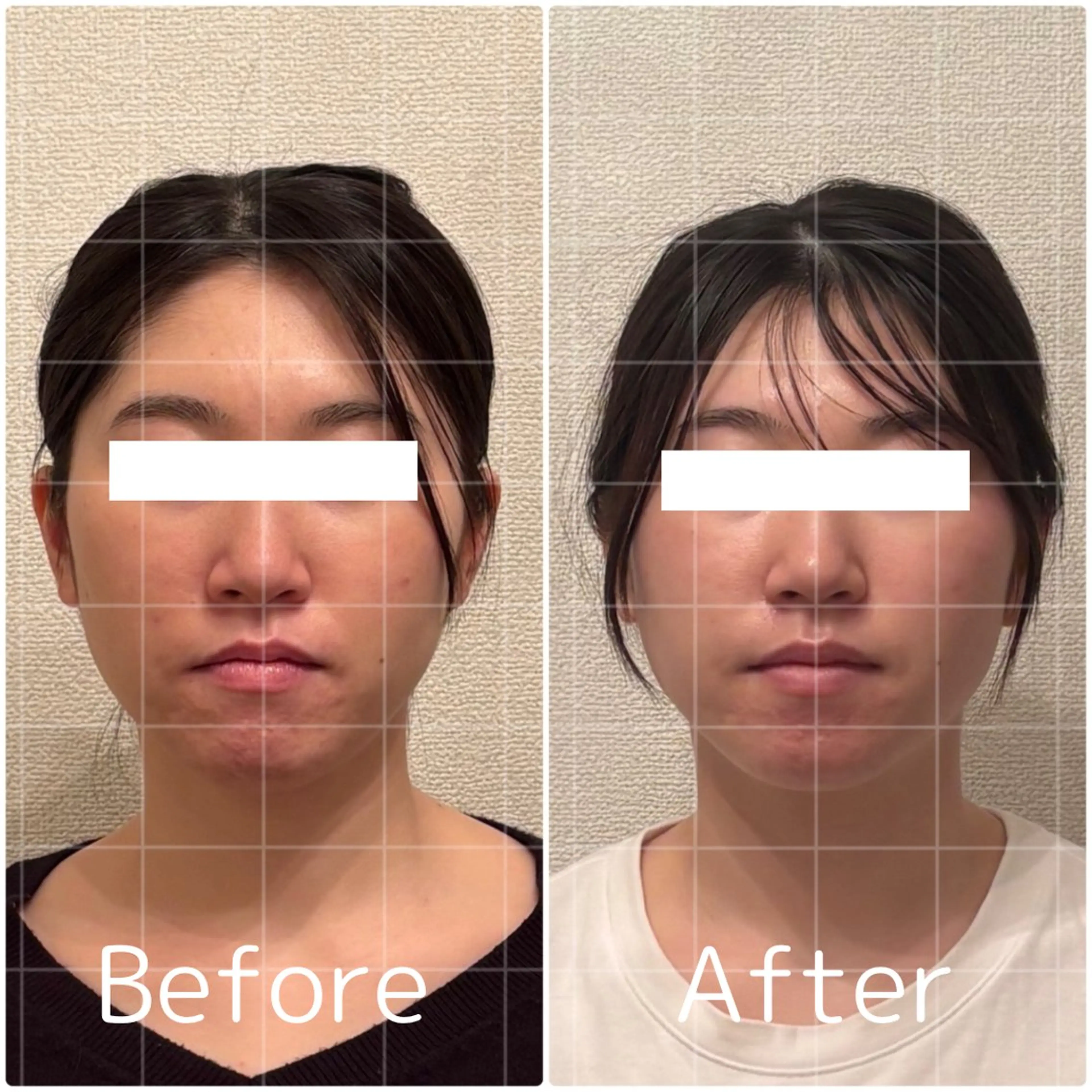 Lily luce 美骨小顔矯正のその他イメージ