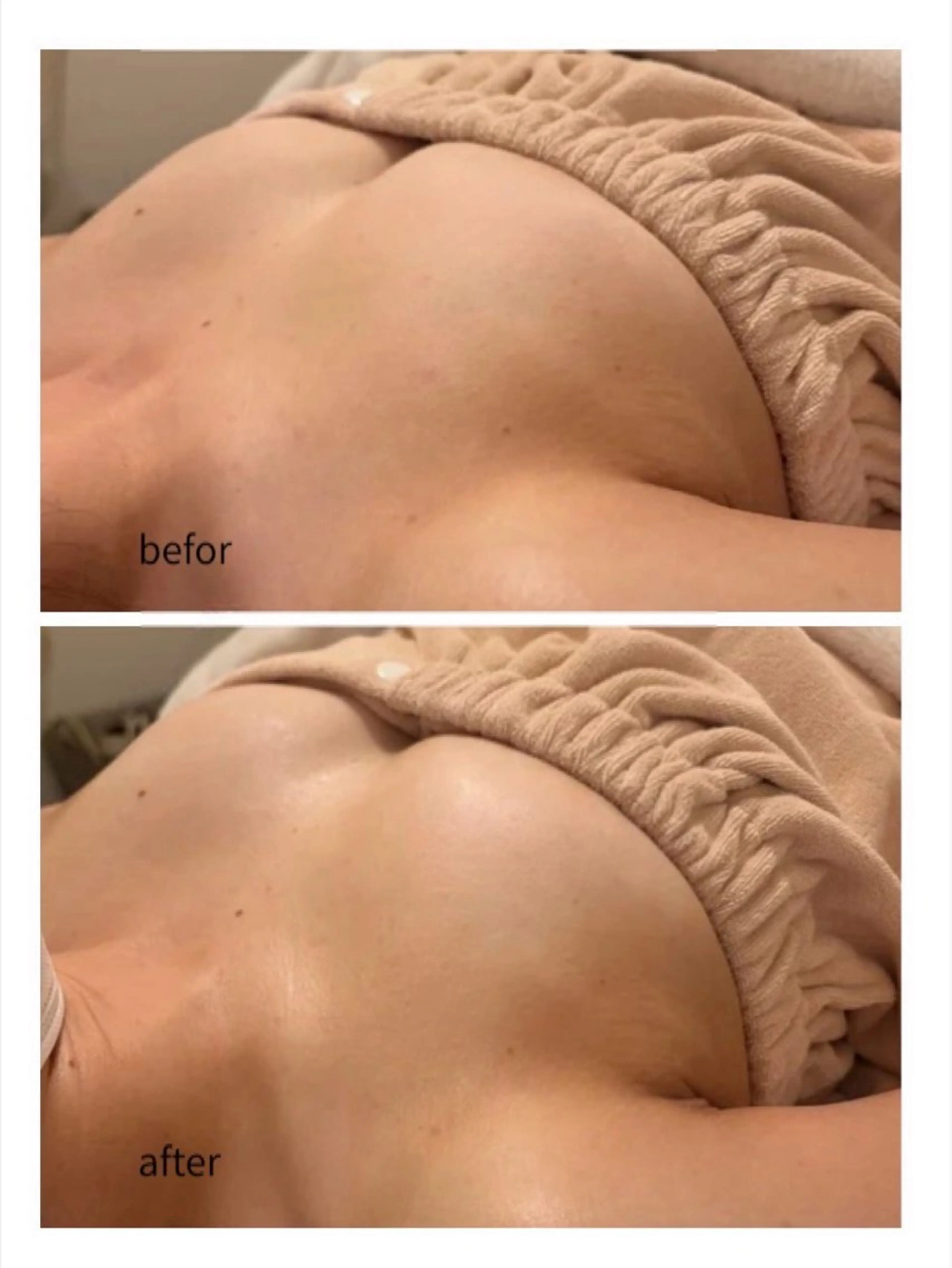 魔法の泡で眠れるバストアップ+リフトアップヘッドスパ+眼精疲労解消アイケアの写真