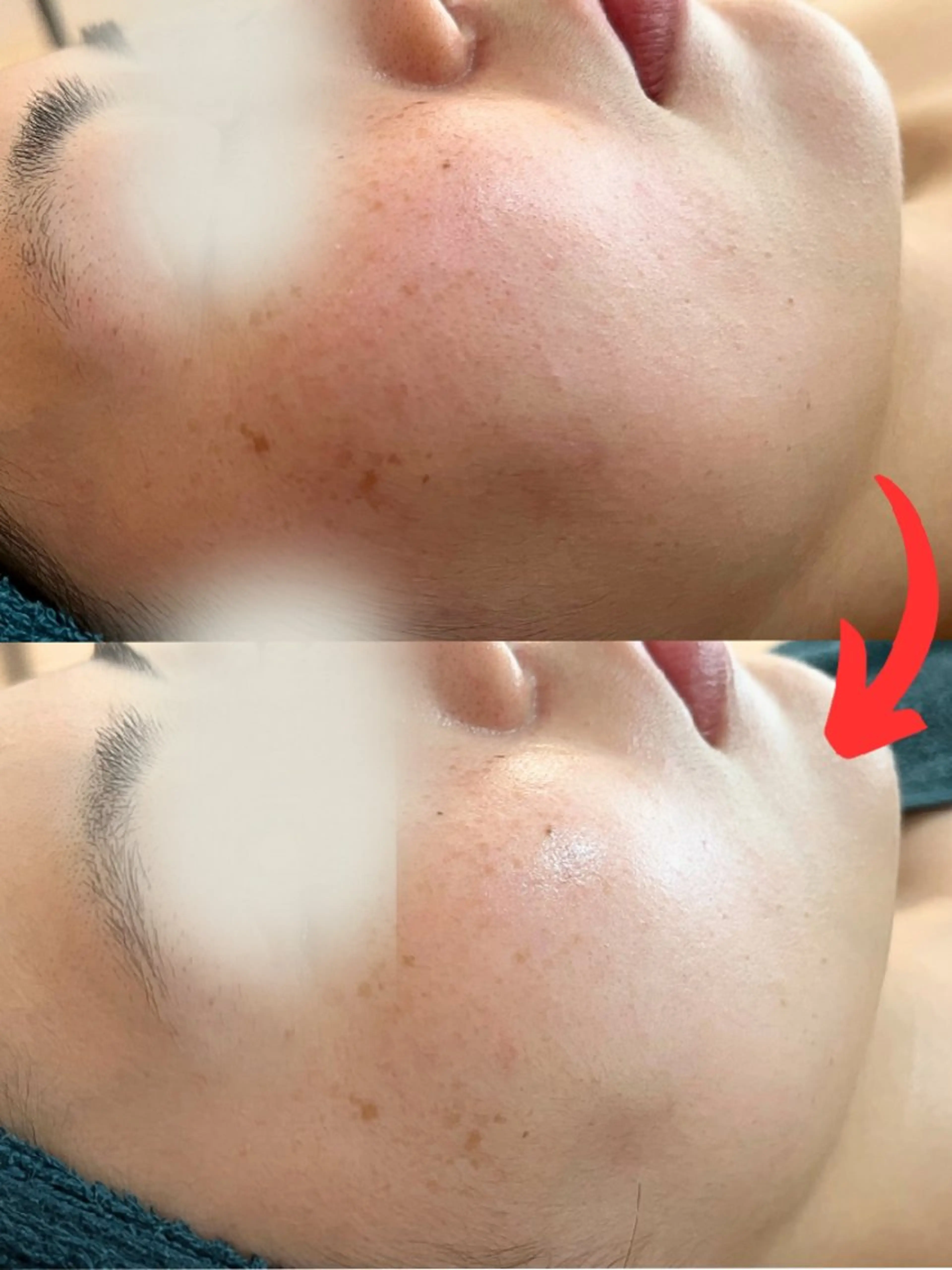 小顔コルギ&肌質改善 の専門店LIBREのエステ・リラクイメージ