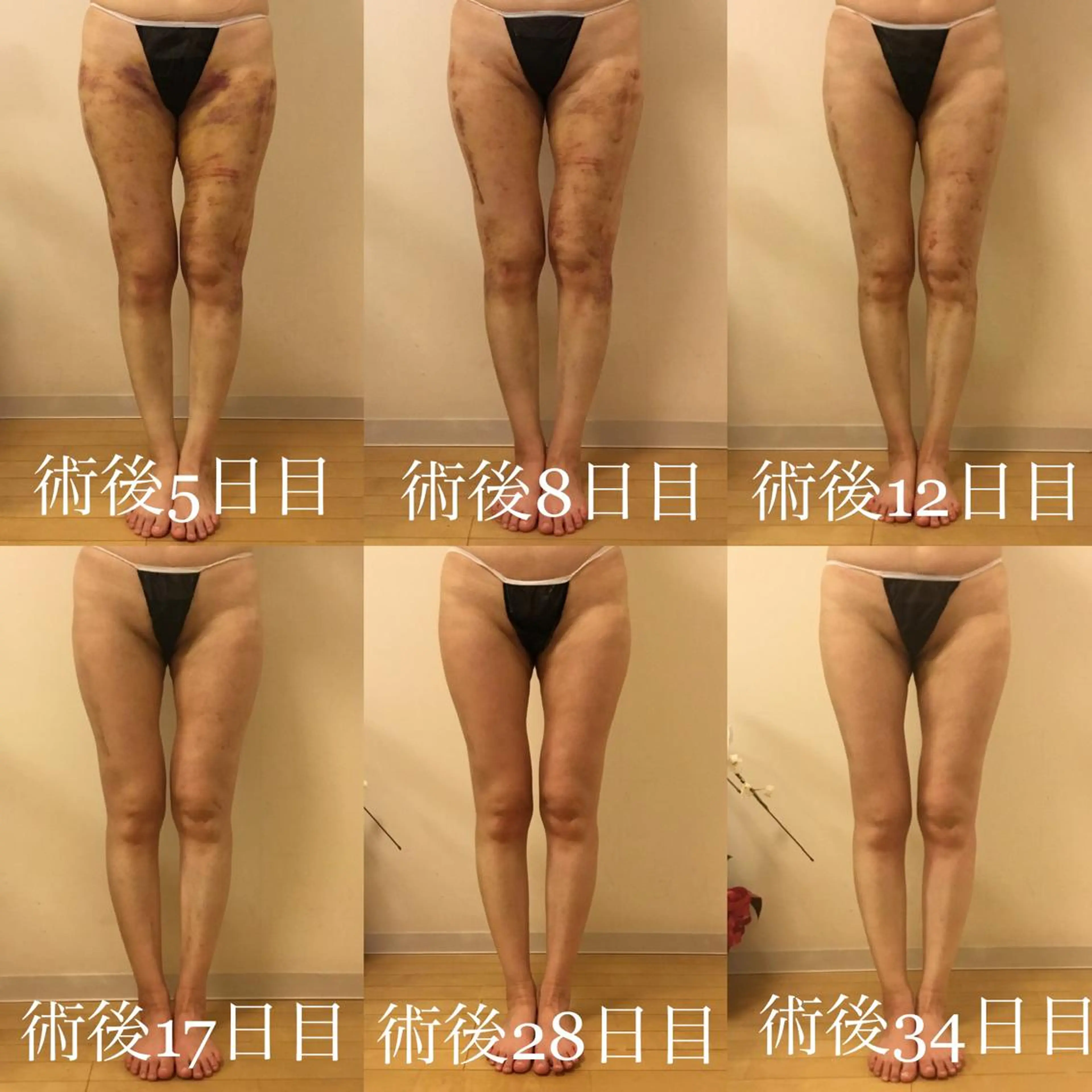 WOM SALON所属・MIKU【美容整形ダ ウンタイムケア銀座】のエステ・リラクイメージ