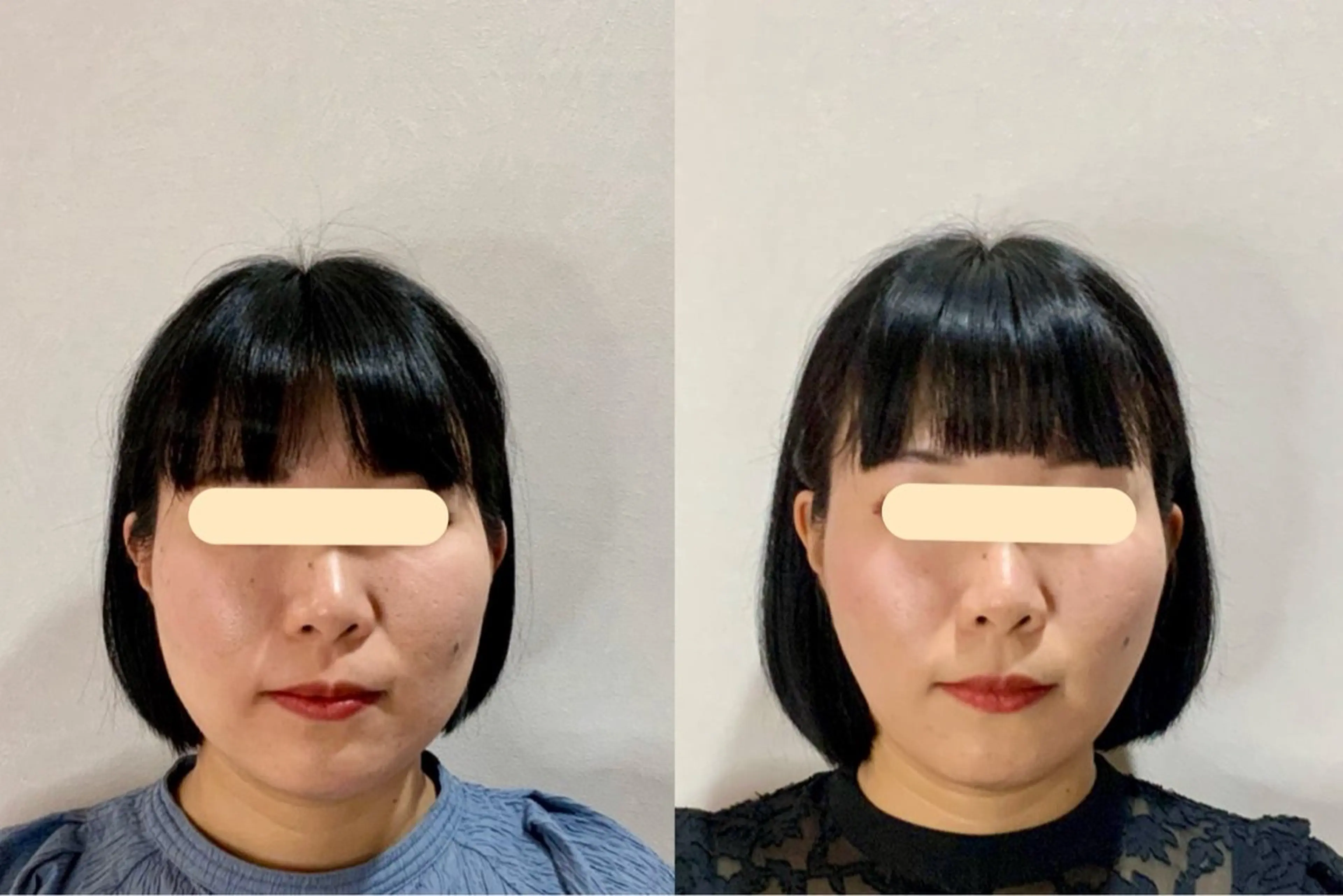 エステ 最速小顔・肌質管理 ❣️エスポワールのエステ・リラクイメージ