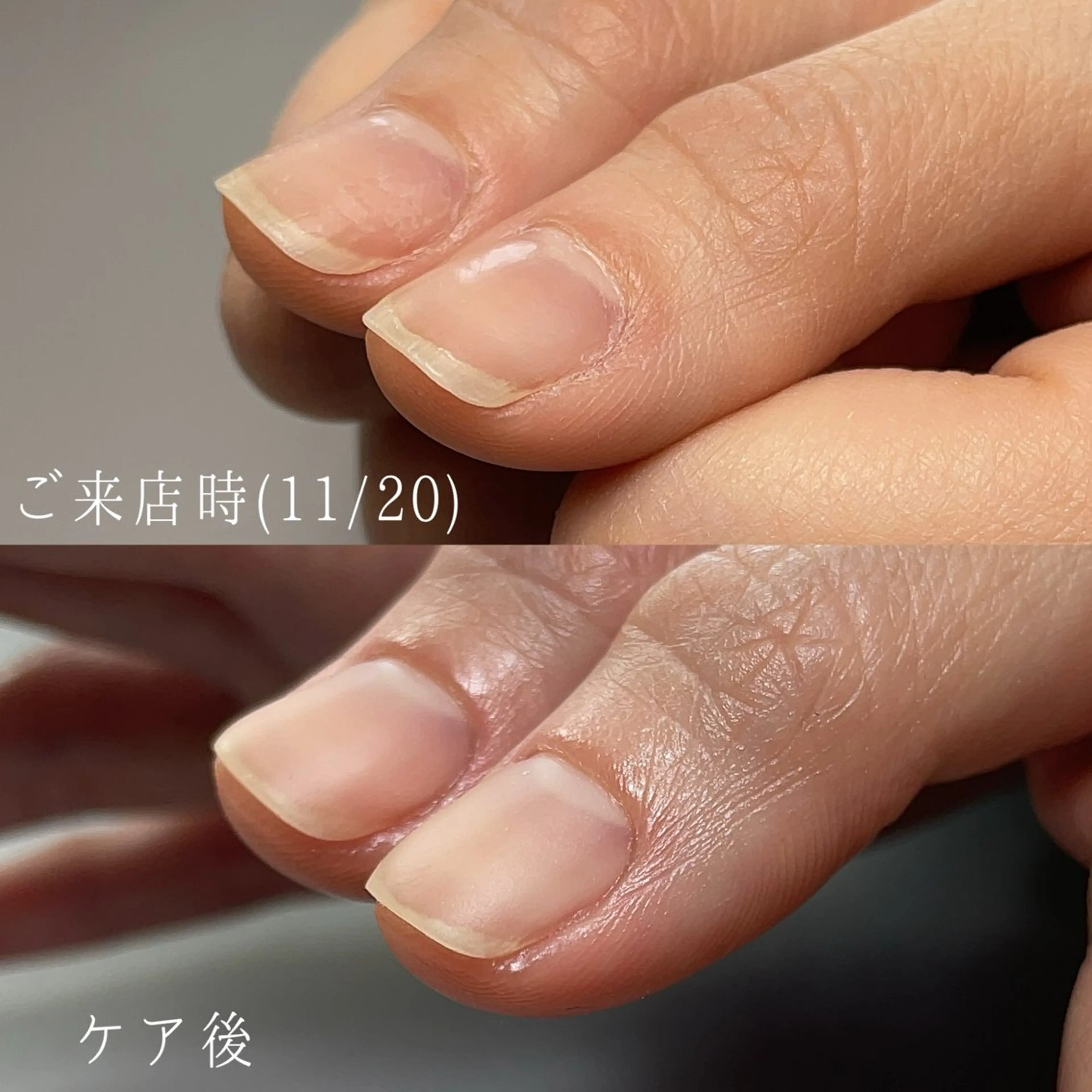 ネイル ジェルネイル Aim* 深爪・自爪育成専門店のネイルデザイン