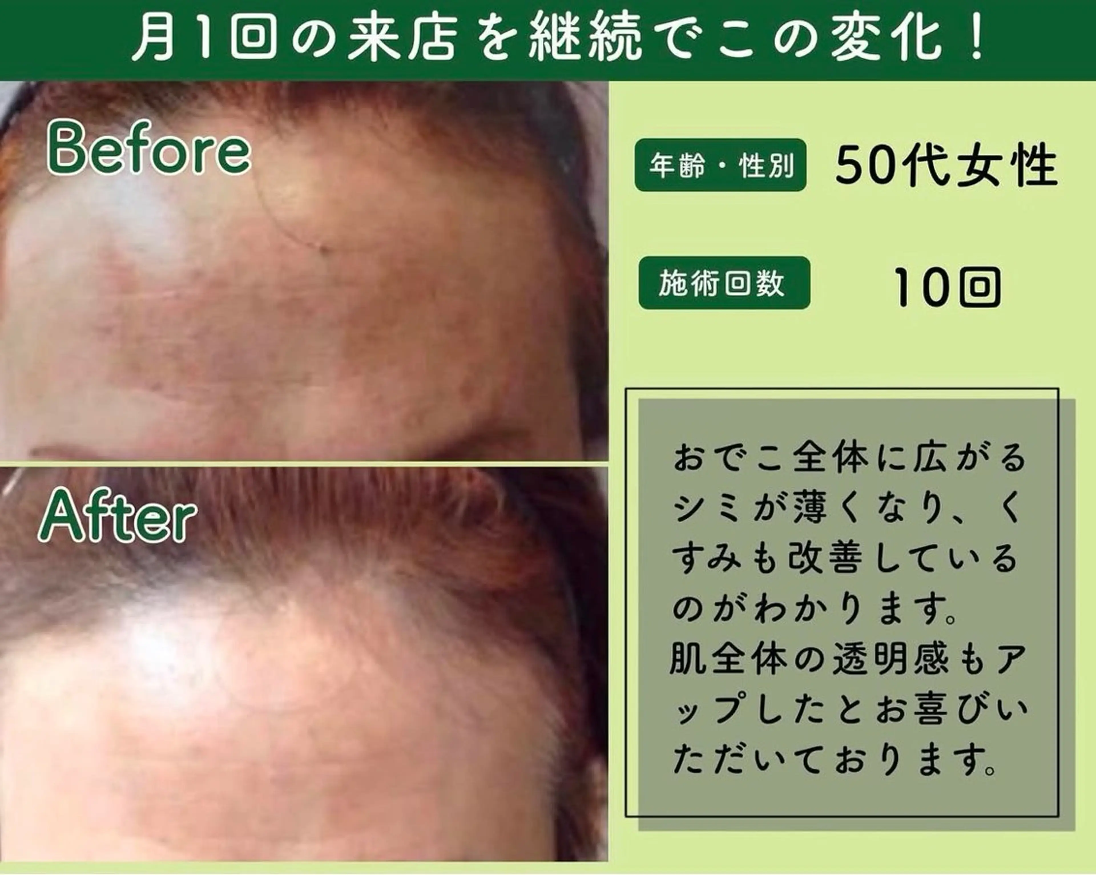 M.plus所属・水光韓国肌ハーブ ピーリングMplusのエステ・リラクイメージ