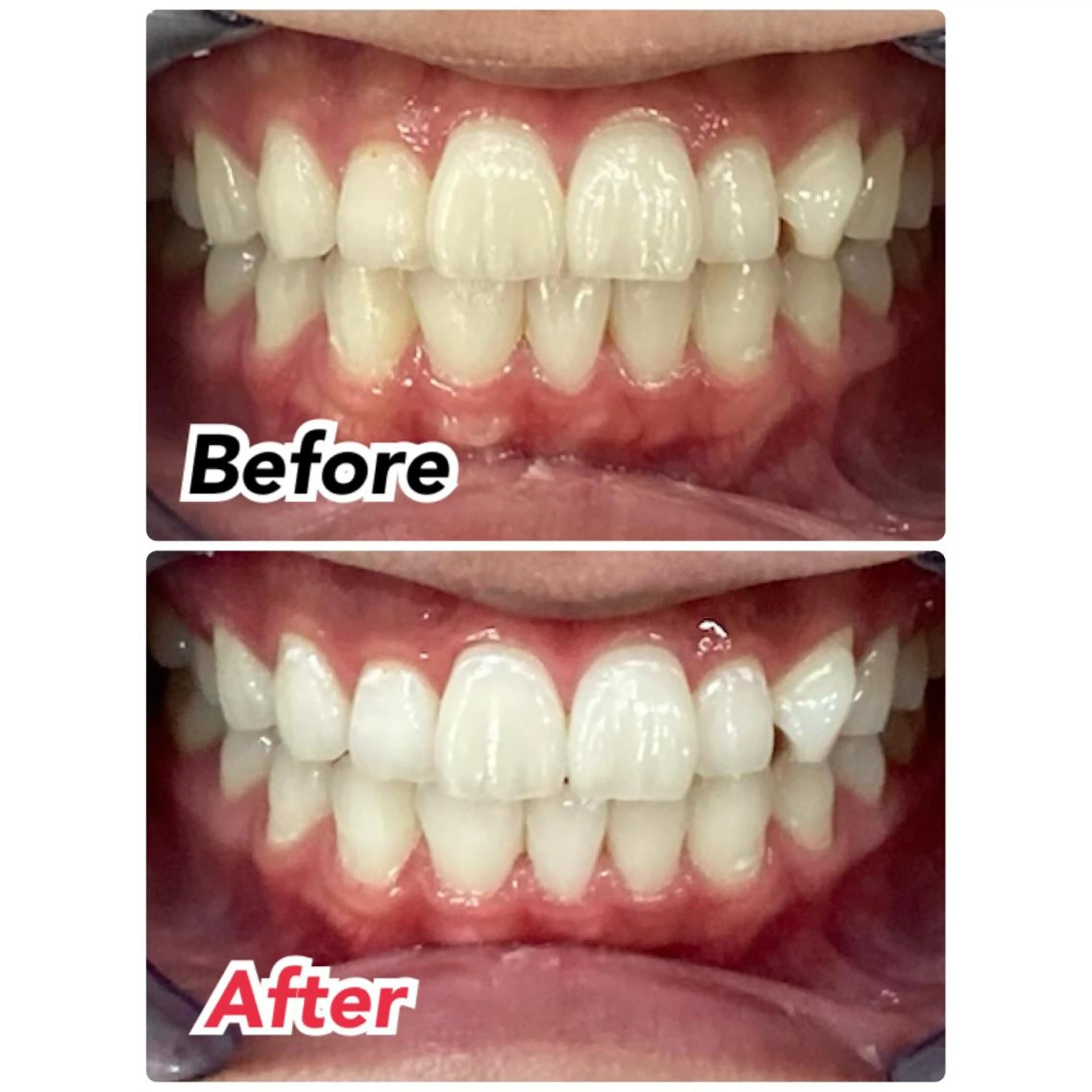 メンズ キッズ プラチナムビューティー柏所属・【歯科提携】柏ホワイ トニングスタイルのその他イメージ