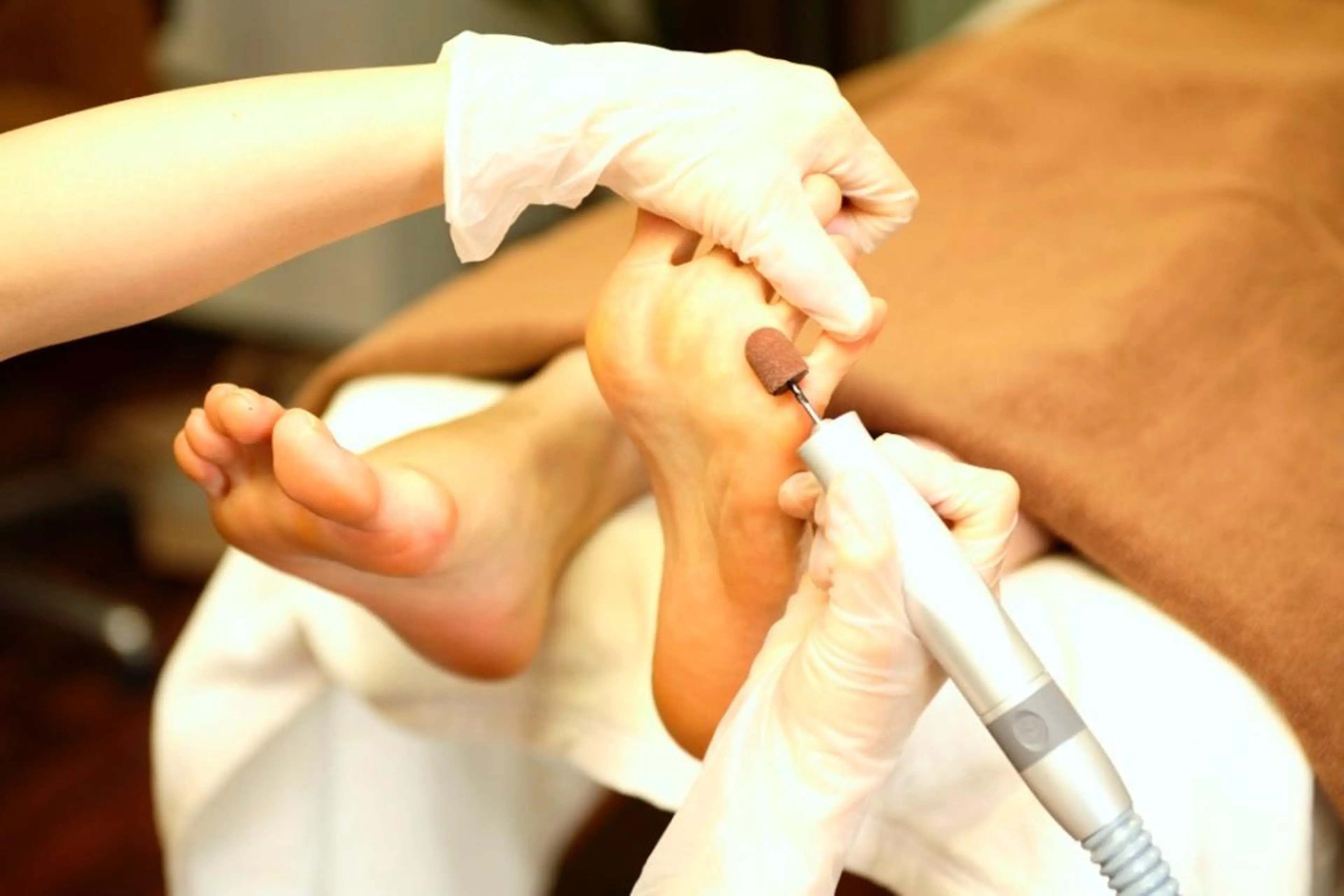 ◆足裏ケア◆【魚の目、タコ、角質など】トラブル低​〜​中程度の写真