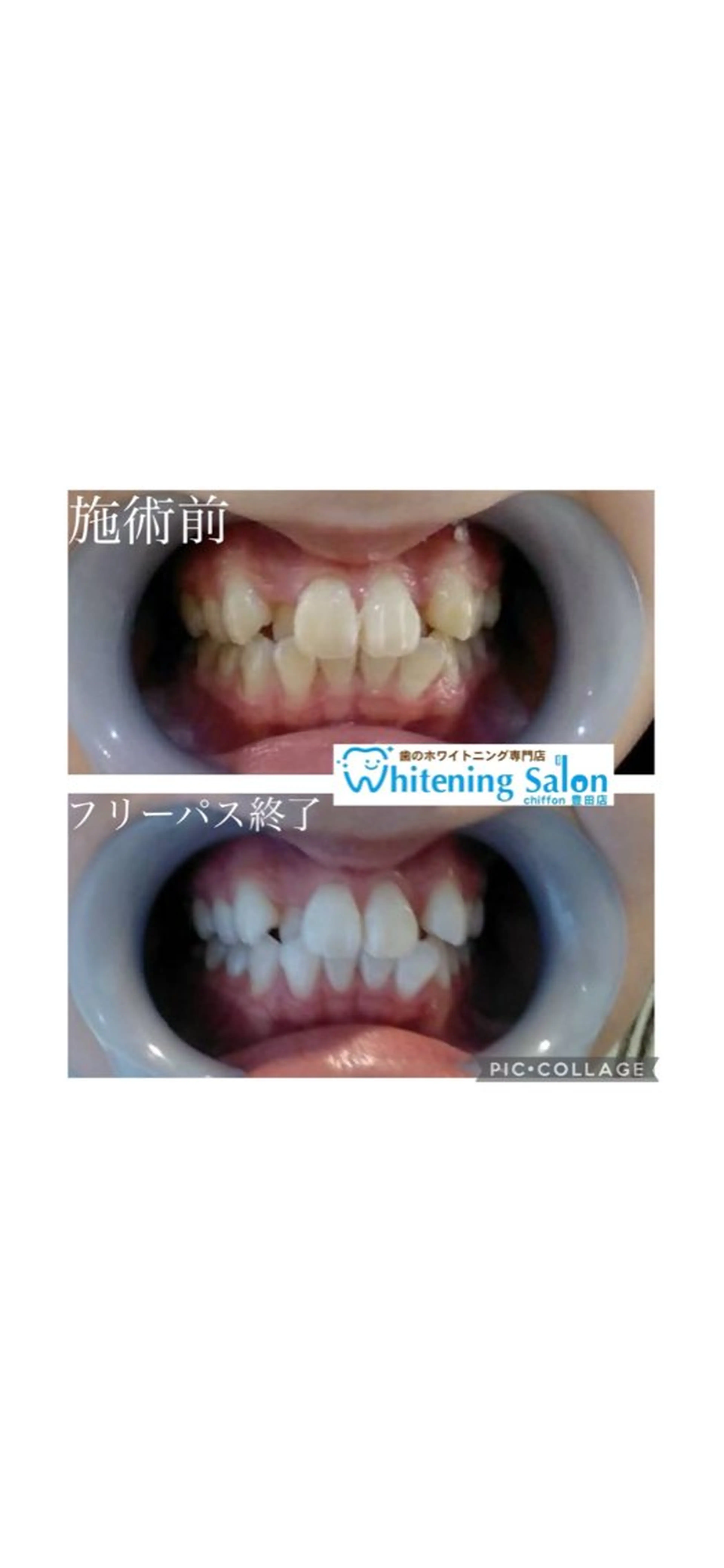 エステ ホワイトニングサロンシフォン豊田店所属・ホワイトニングサロン シフォン豊田店のその他イメージ