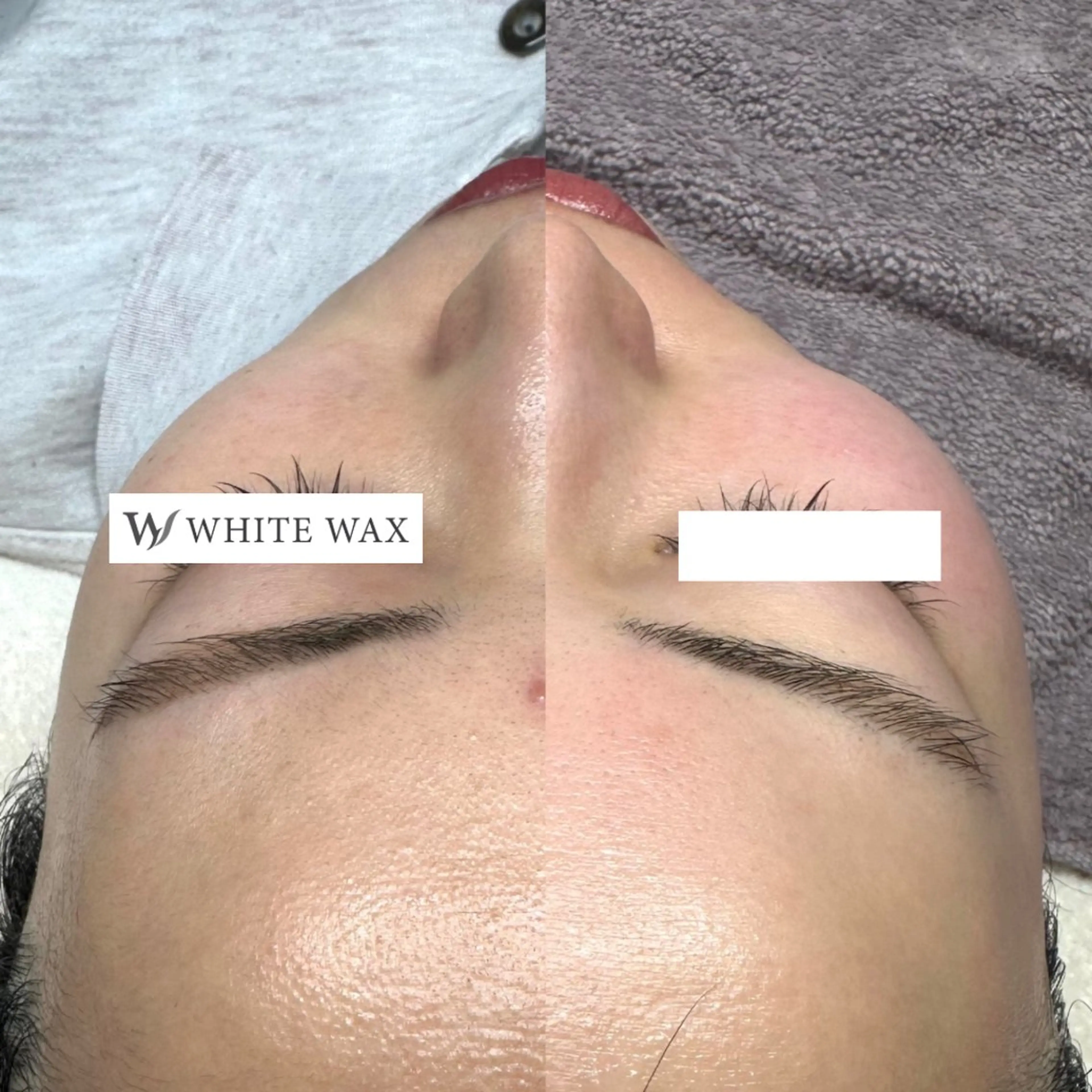 脱毛 フェイシャルワックス KANAKOのエステ・リラクイメージ