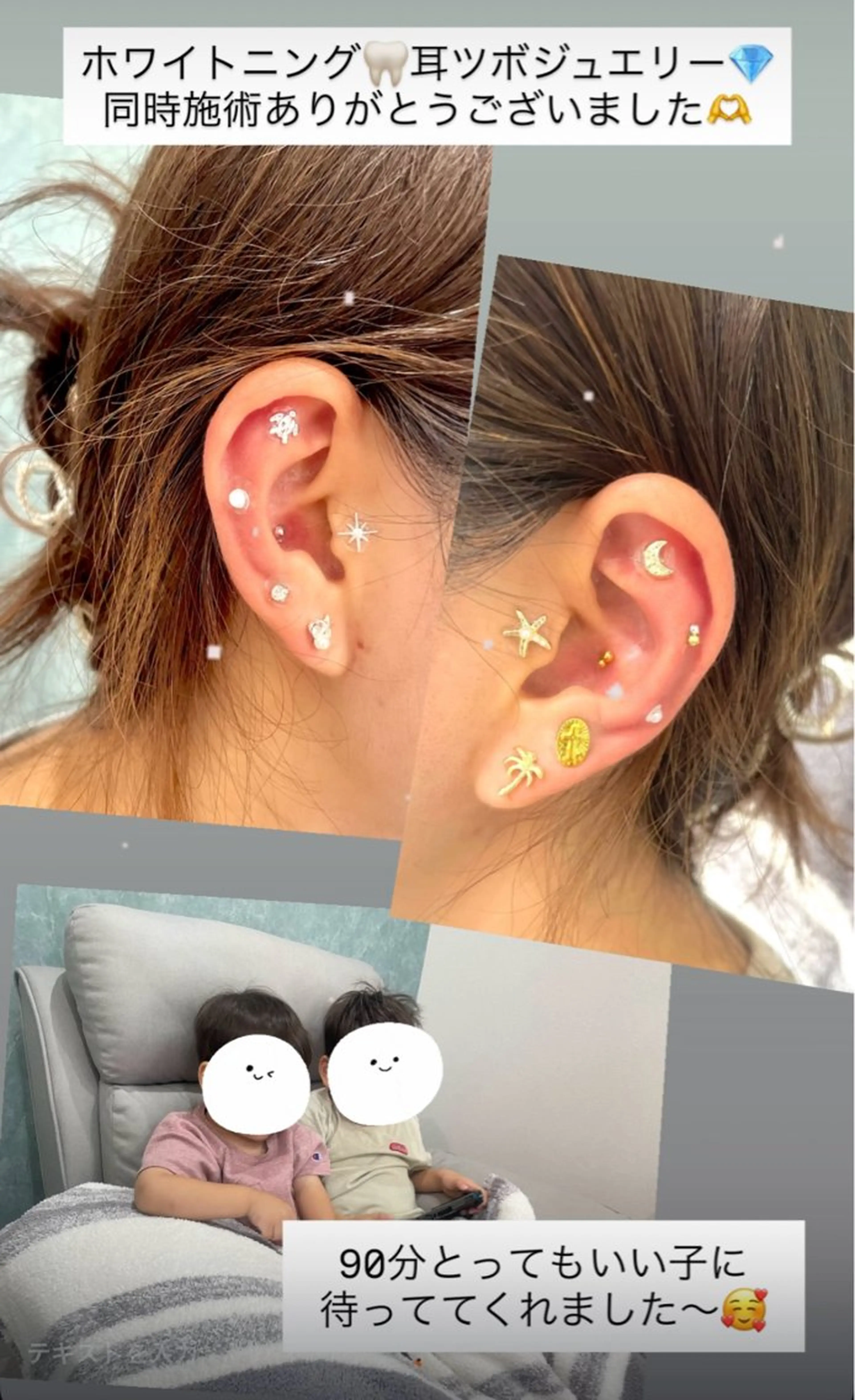 Kaula所属・Kaula ホワイトニング耳ツボのその他イメージ