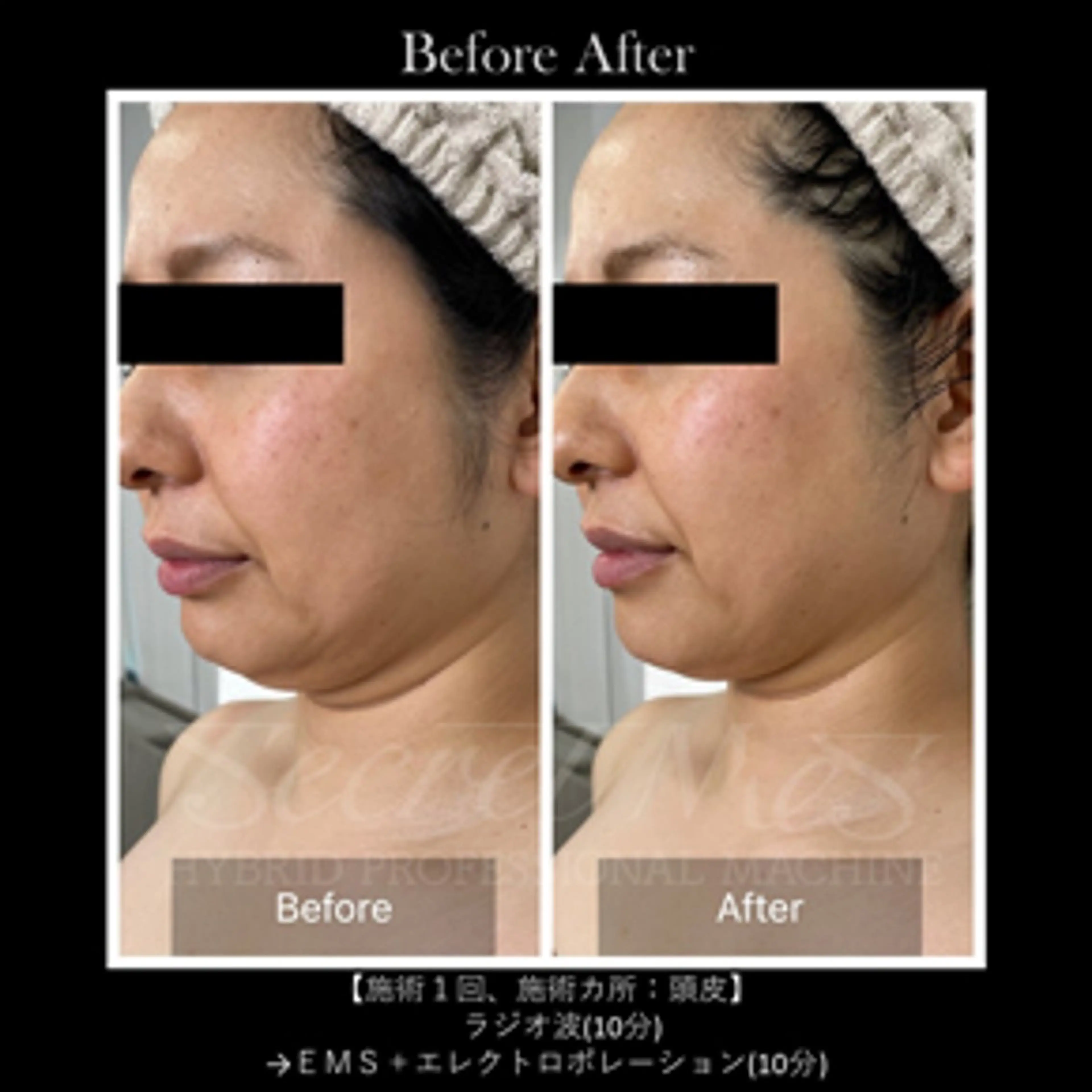 伊藤 正美のマツエク・マツパデザイン