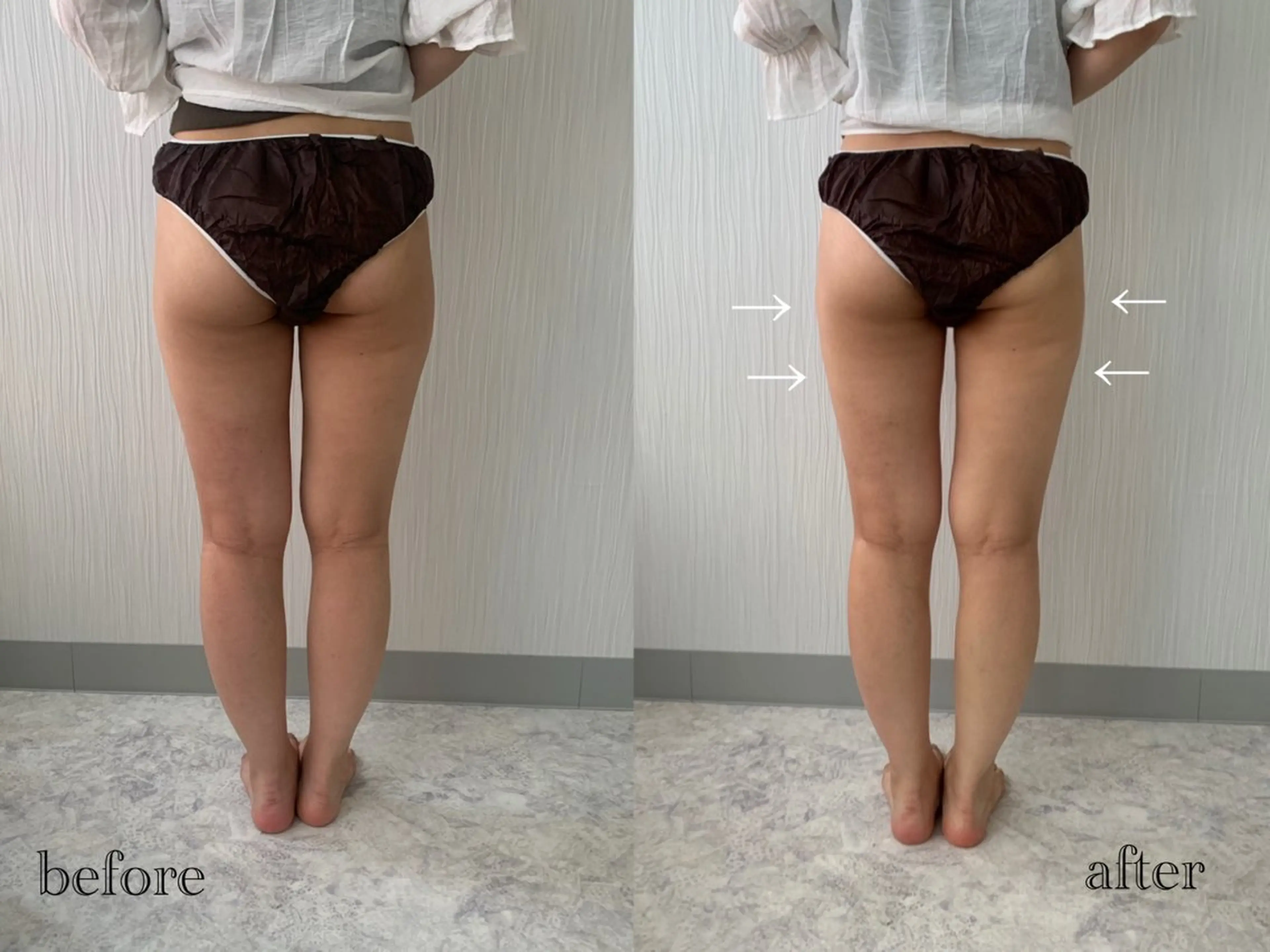 【都度払い専門】エステサロンARTI,天神大名店所属・【都度払い専門店】 エステサロARTI,のエステ・リラクイメージ