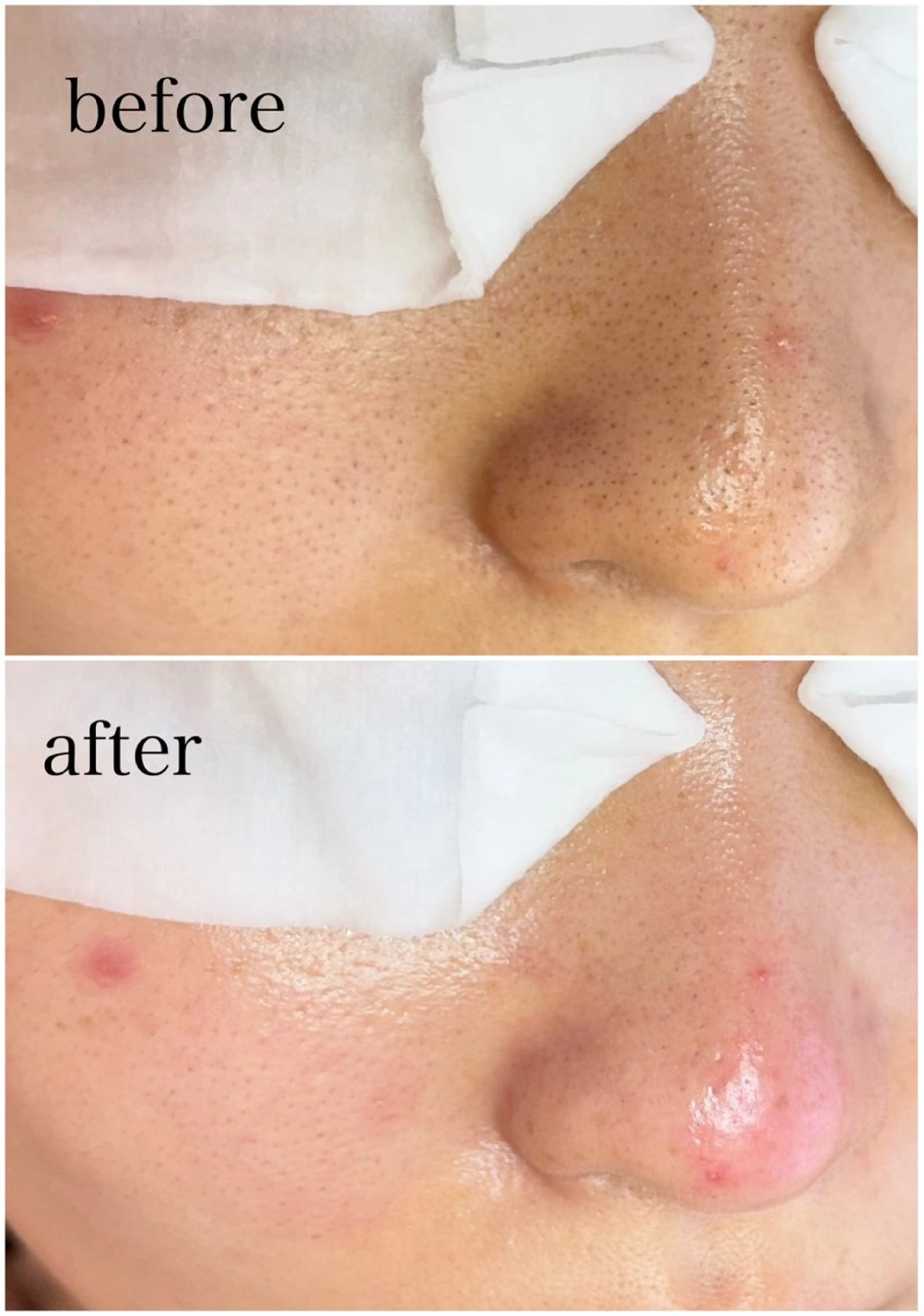 エステ 姫路/毛穴専門店 'AMOのエステ・リラクイメージ