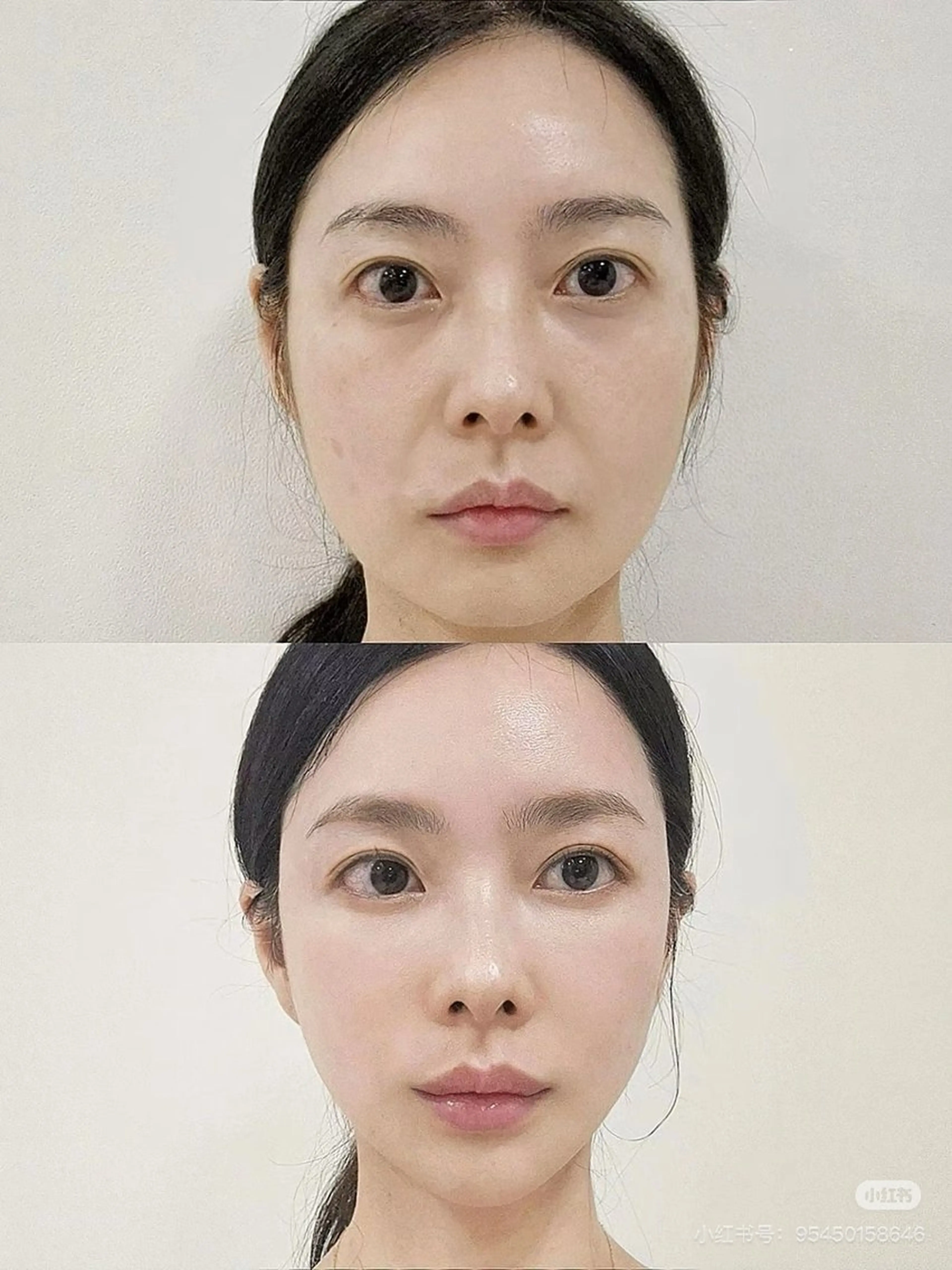 ネイル エステ aliaハイフ&水光ジェットサロン所属・aliaハーブ水光店 エステティシャン募集のエステ・リラクイメージ