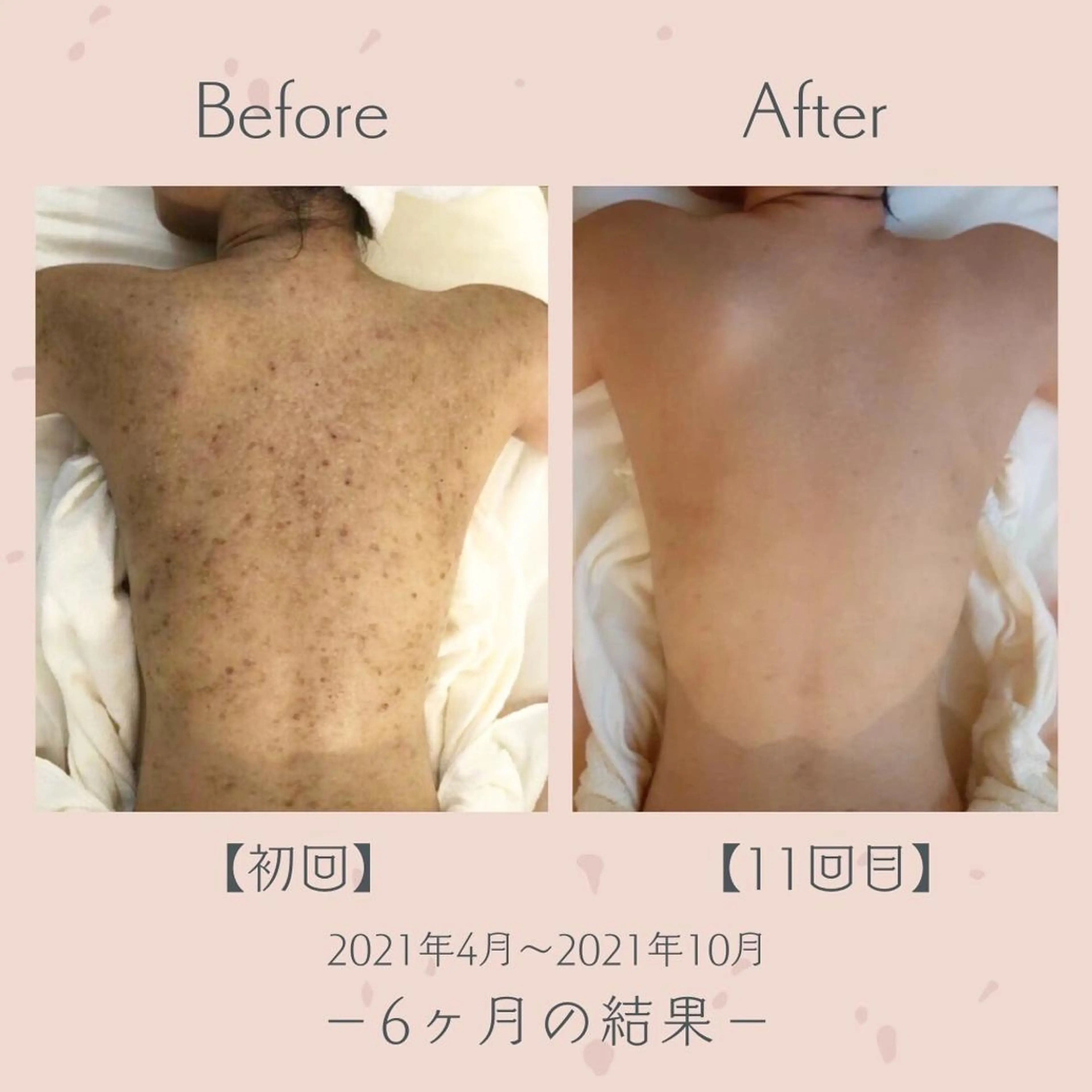 エステ＆美肌脱毛 ココサロ倉敷店のエステ・リラクイメージ