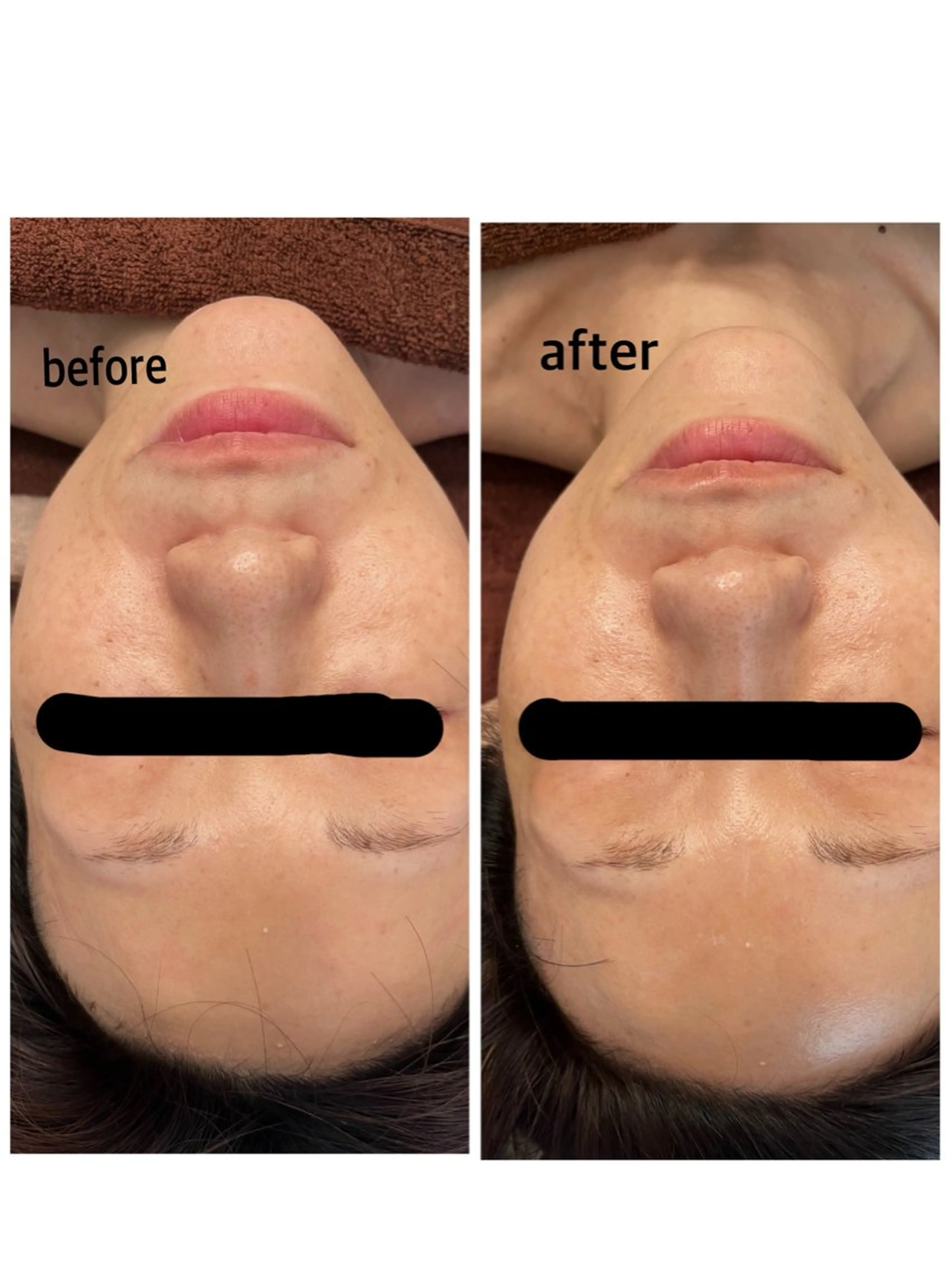 エステ mignonneミニョンヌ*所属・mignonne ミニョンヌのエステ・リラクイメージ