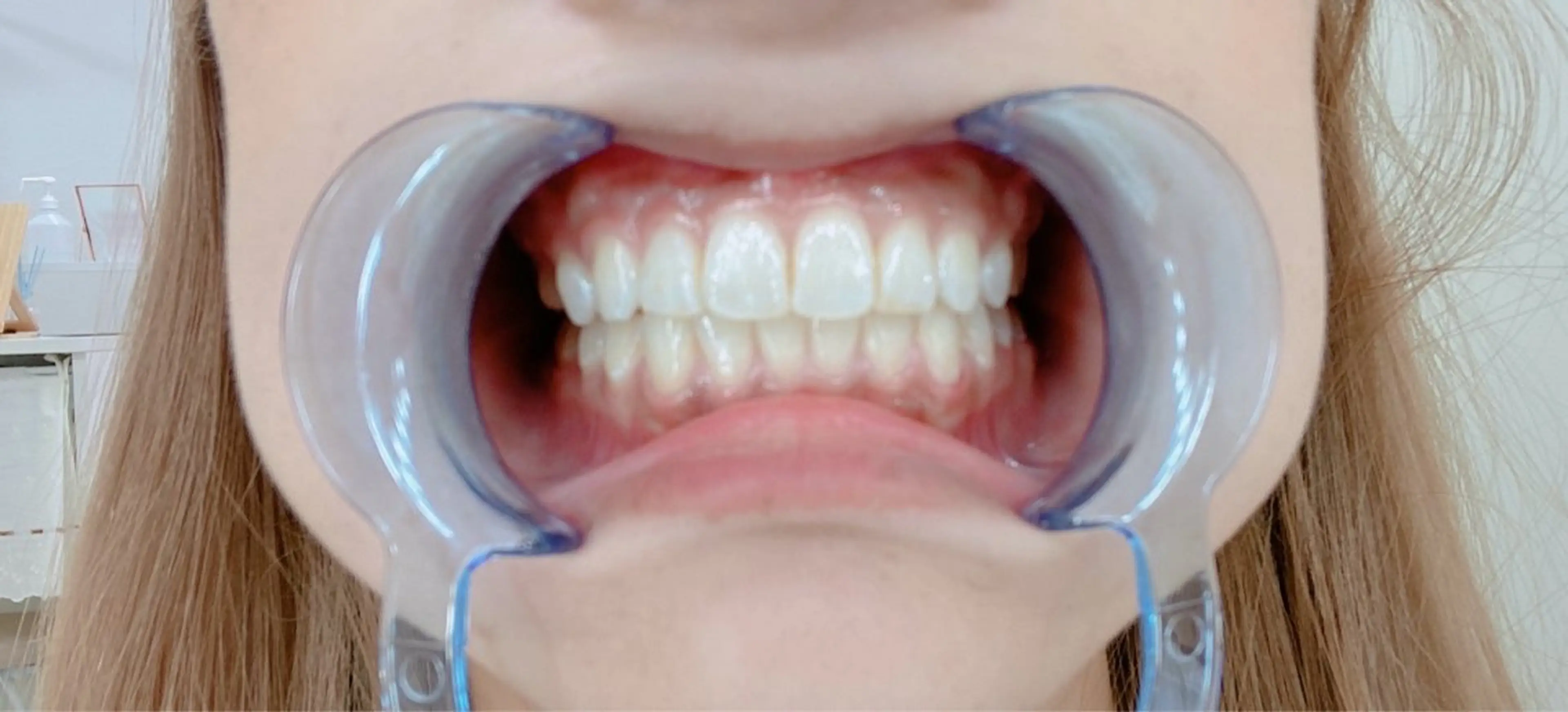 ecxia white 高田馬場所属・セルフホワイトニング エクシア 高田馬場のその他イメージ