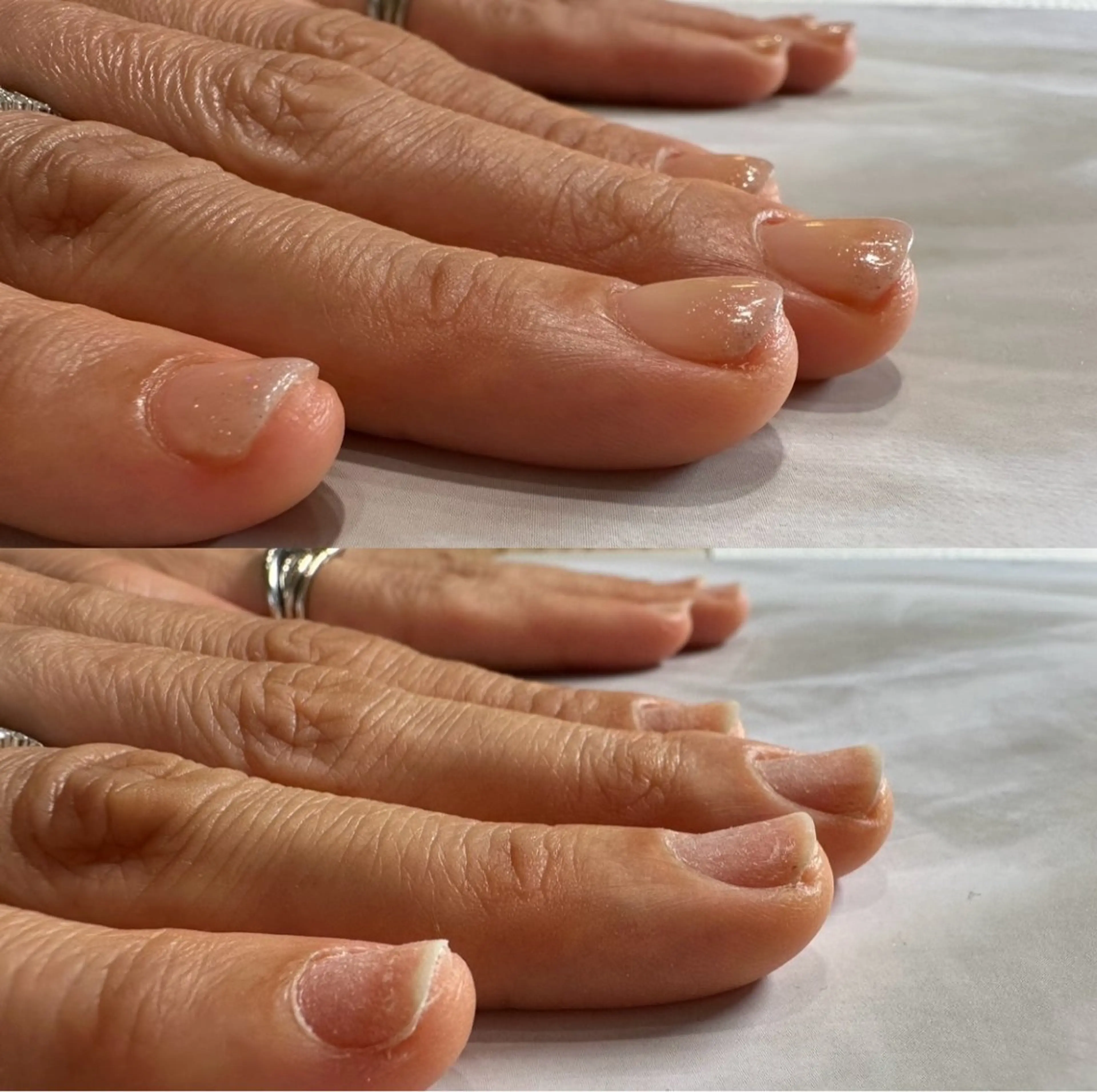 ネイル 深爪矯正専門店ネイルサロンKUU所属・深爪矯正専門店 ネイルサロンKUUのネイルデザイン