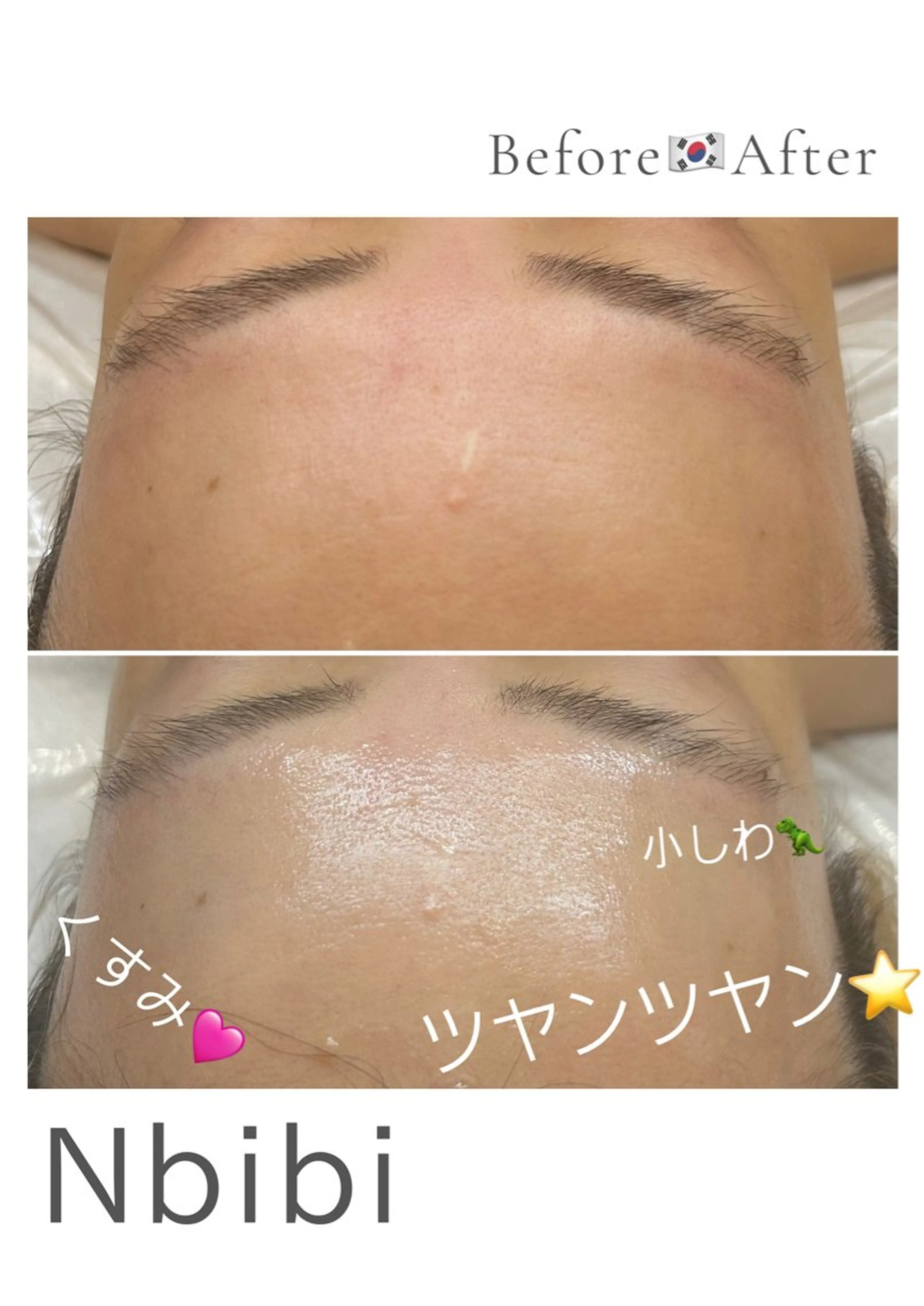 韓国🇰🇷価格 サロン_Nbibiのエステ・リラクイメージ