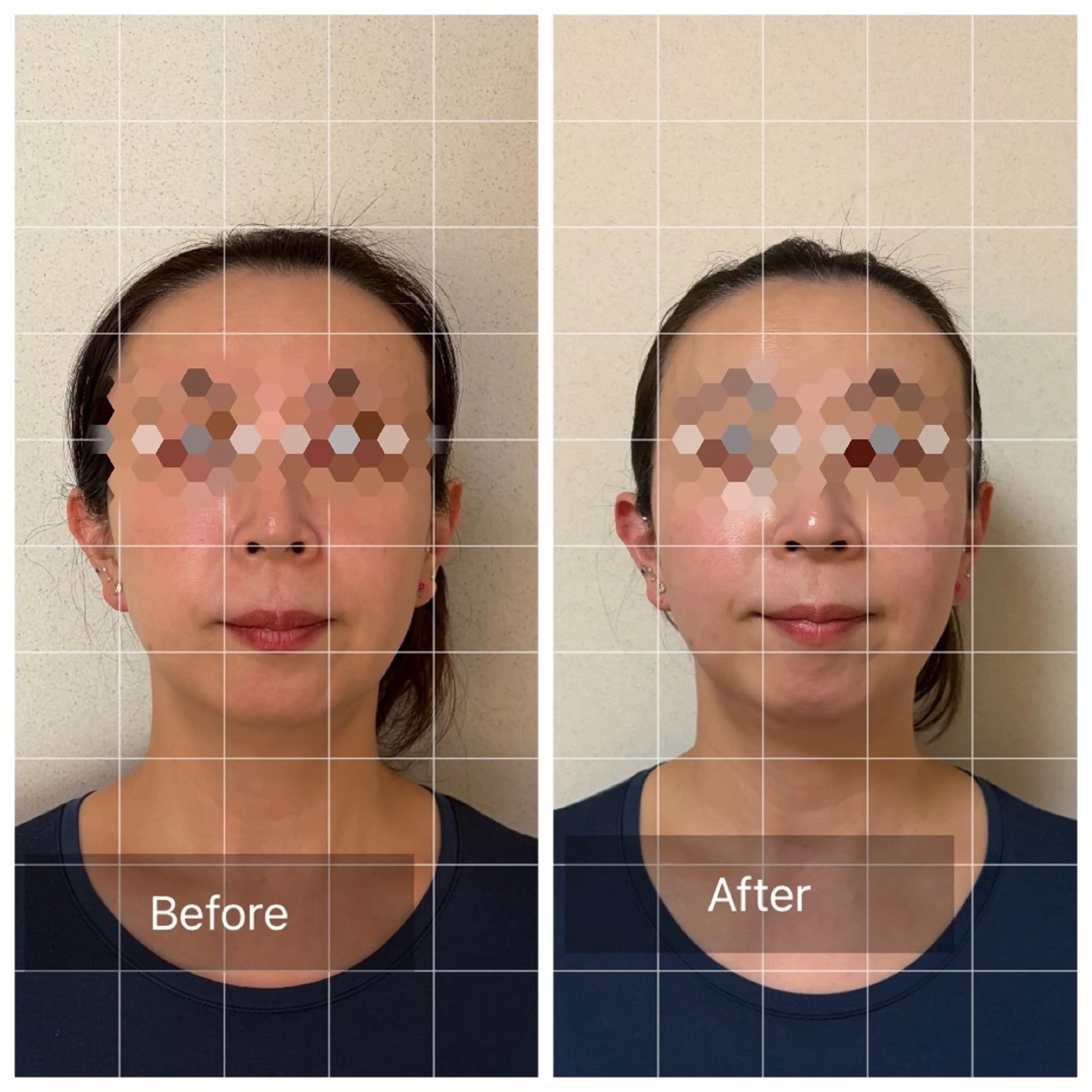 エステ リラク 勝山式美容矯正サロン　るりあん所属・山口 真由子のエステ・リラクイメージ