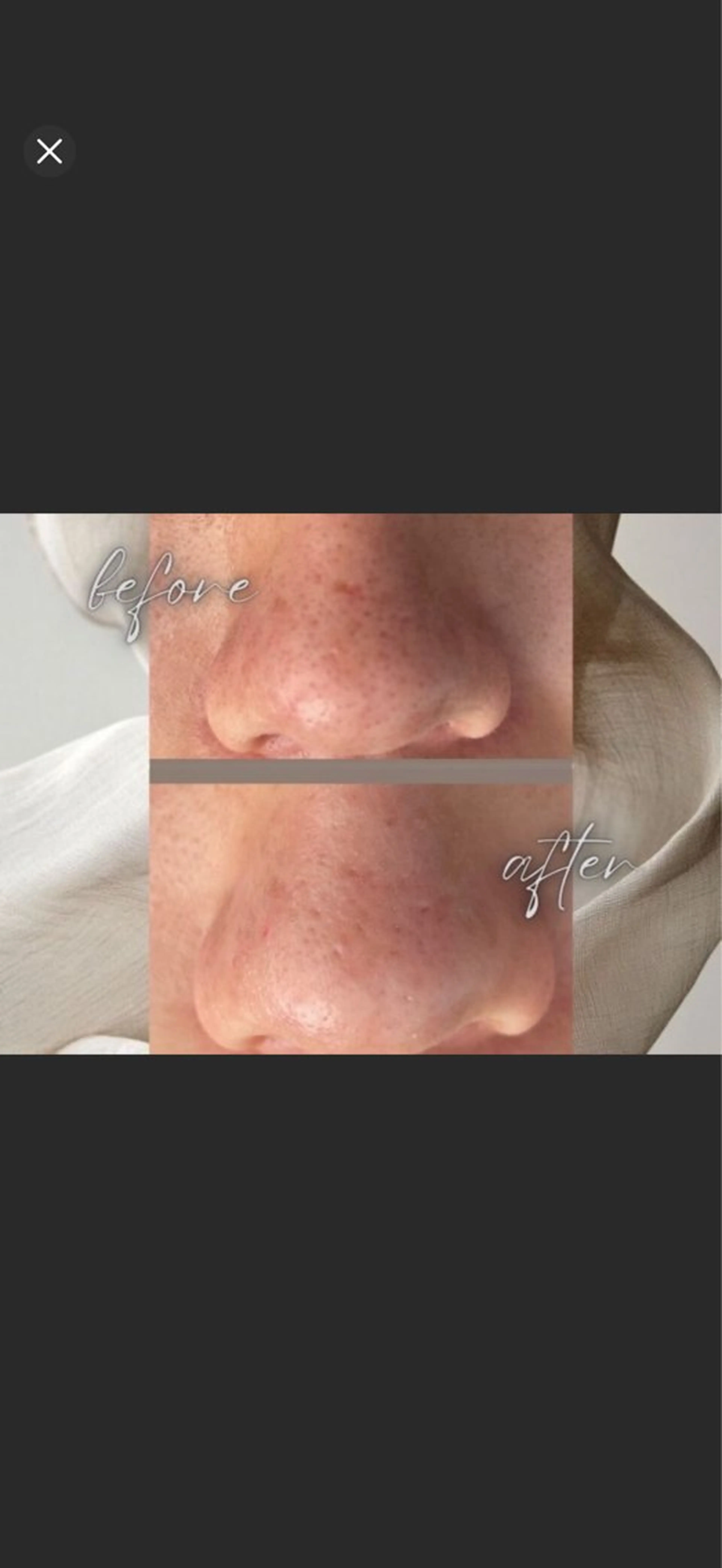 小顔・毛穴/ニキビ/ ハーブピーリング専門のエステ・リラクイメージ