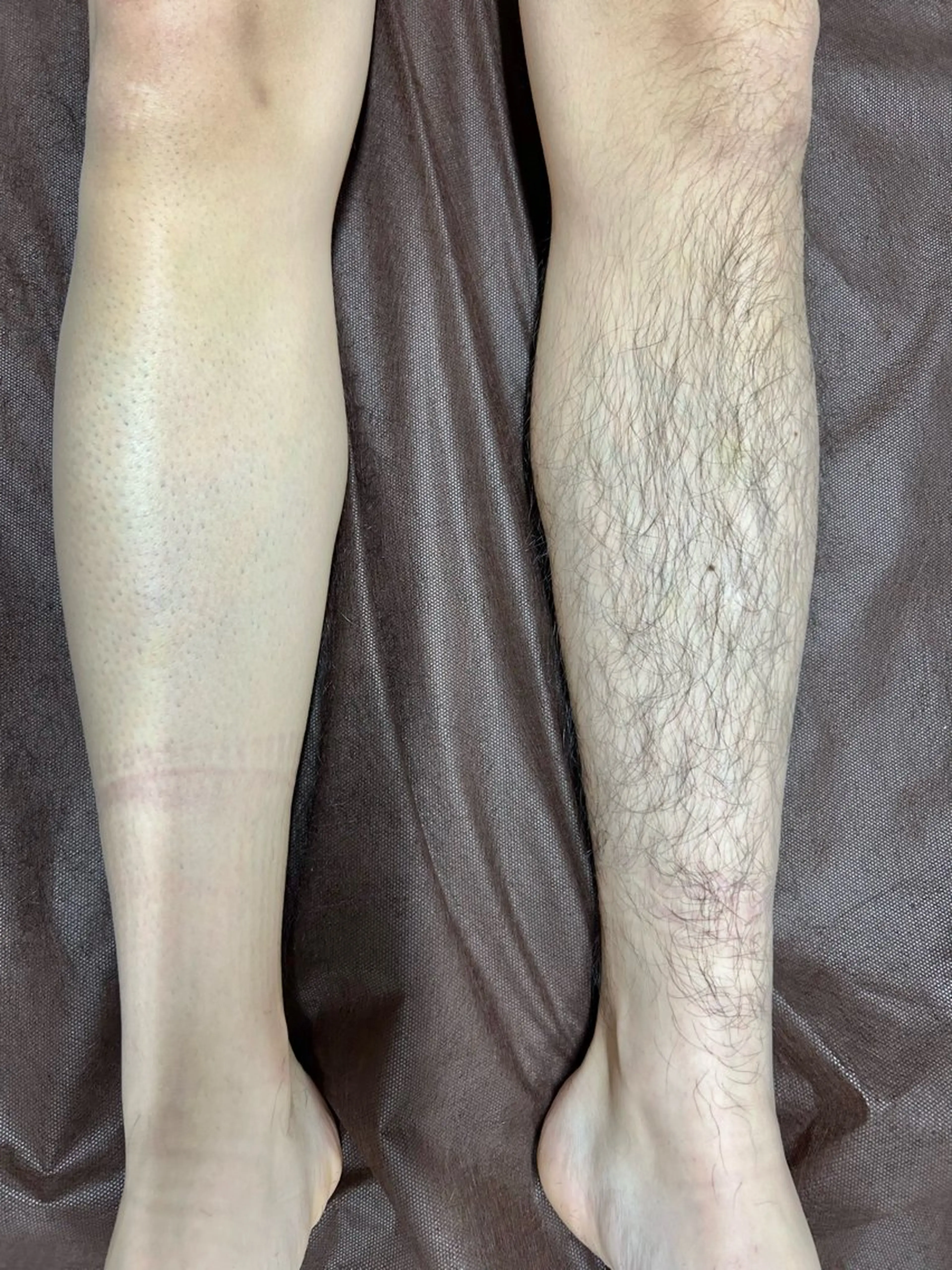 メンズ 脱毛 SOLUNA(ソルーナ)所属・SOLUNA 💛staffのエステ・リラクイメージ