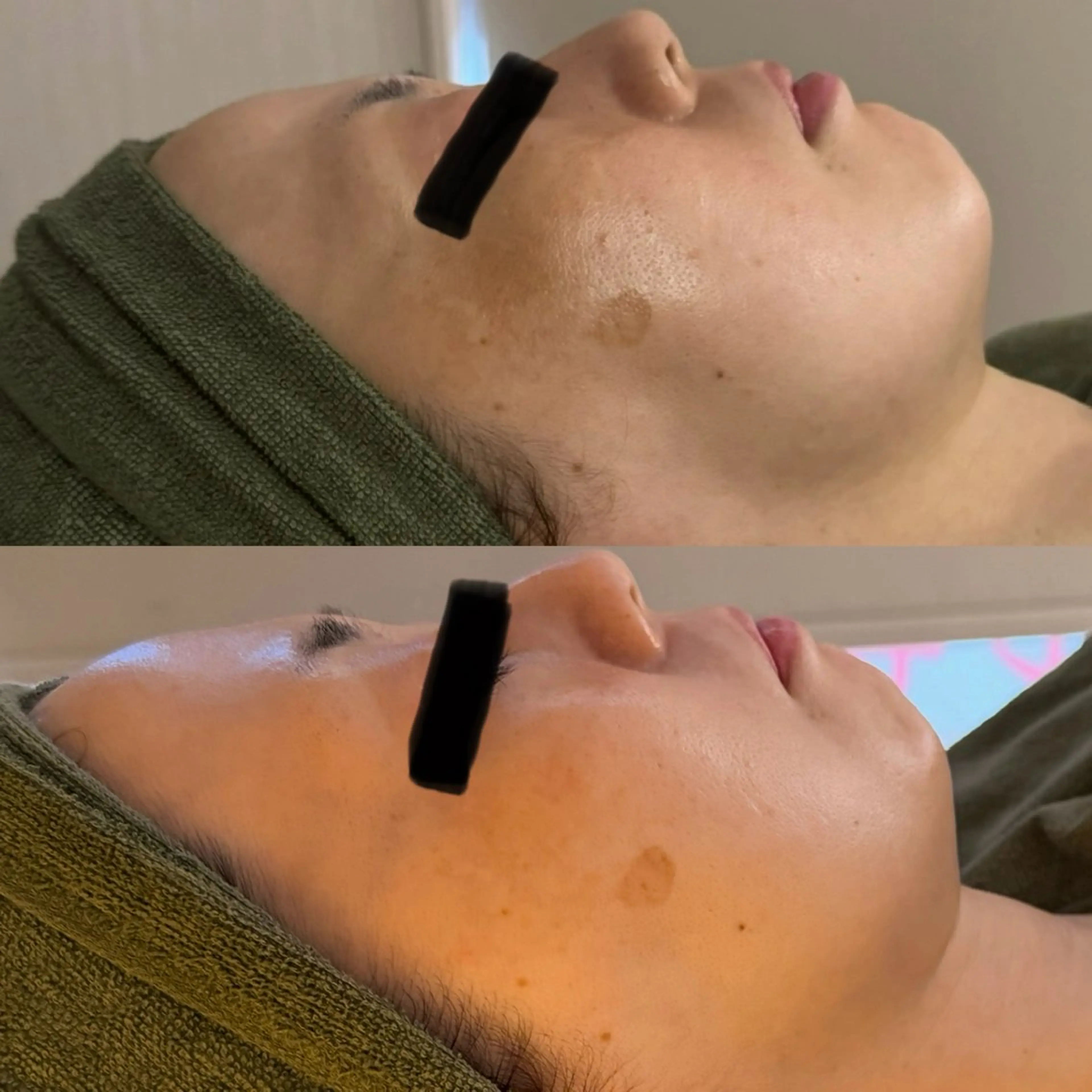 エステ リラク よもぎ蒸しサロンc.iエステティック所属・睡眠の質／体質改善 c.iエステティックのエステ・リラクイメージ