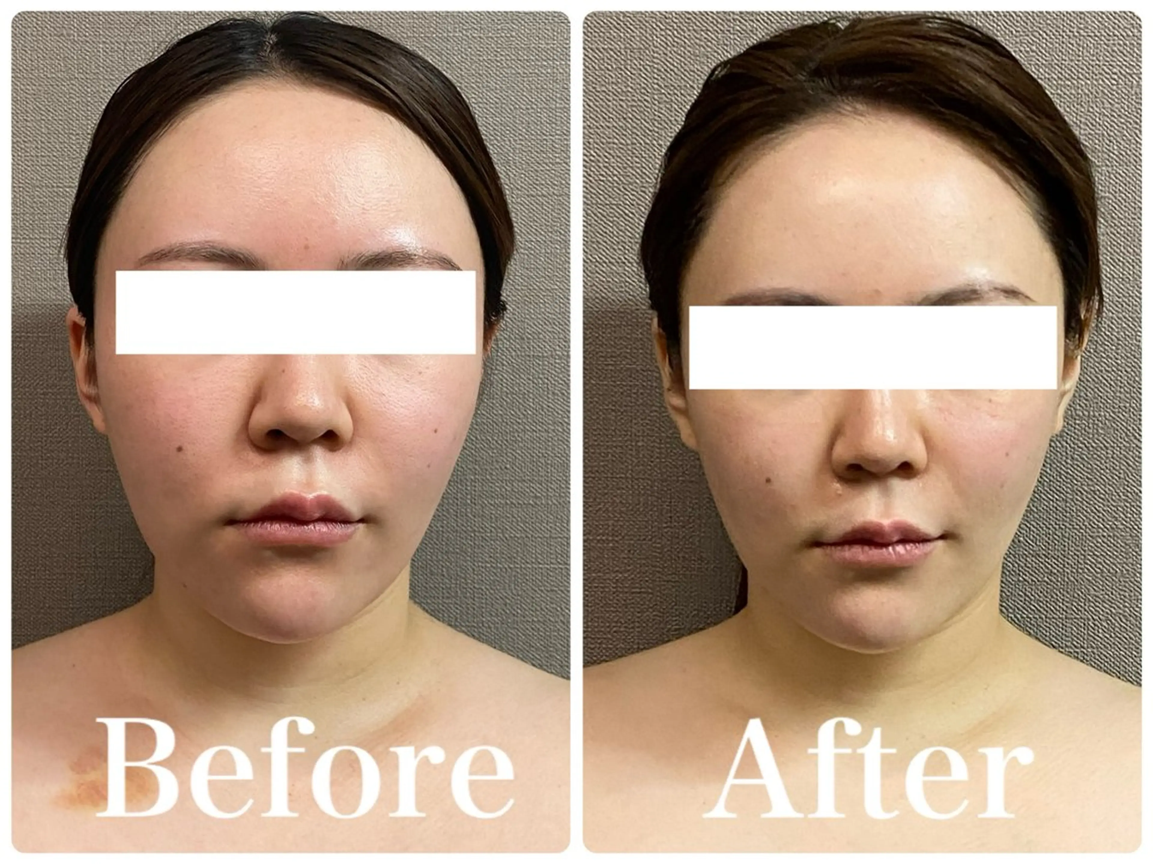 💎小顔ｻﾛﾝ アリリン銀座💎のエステ・リラクイメージ