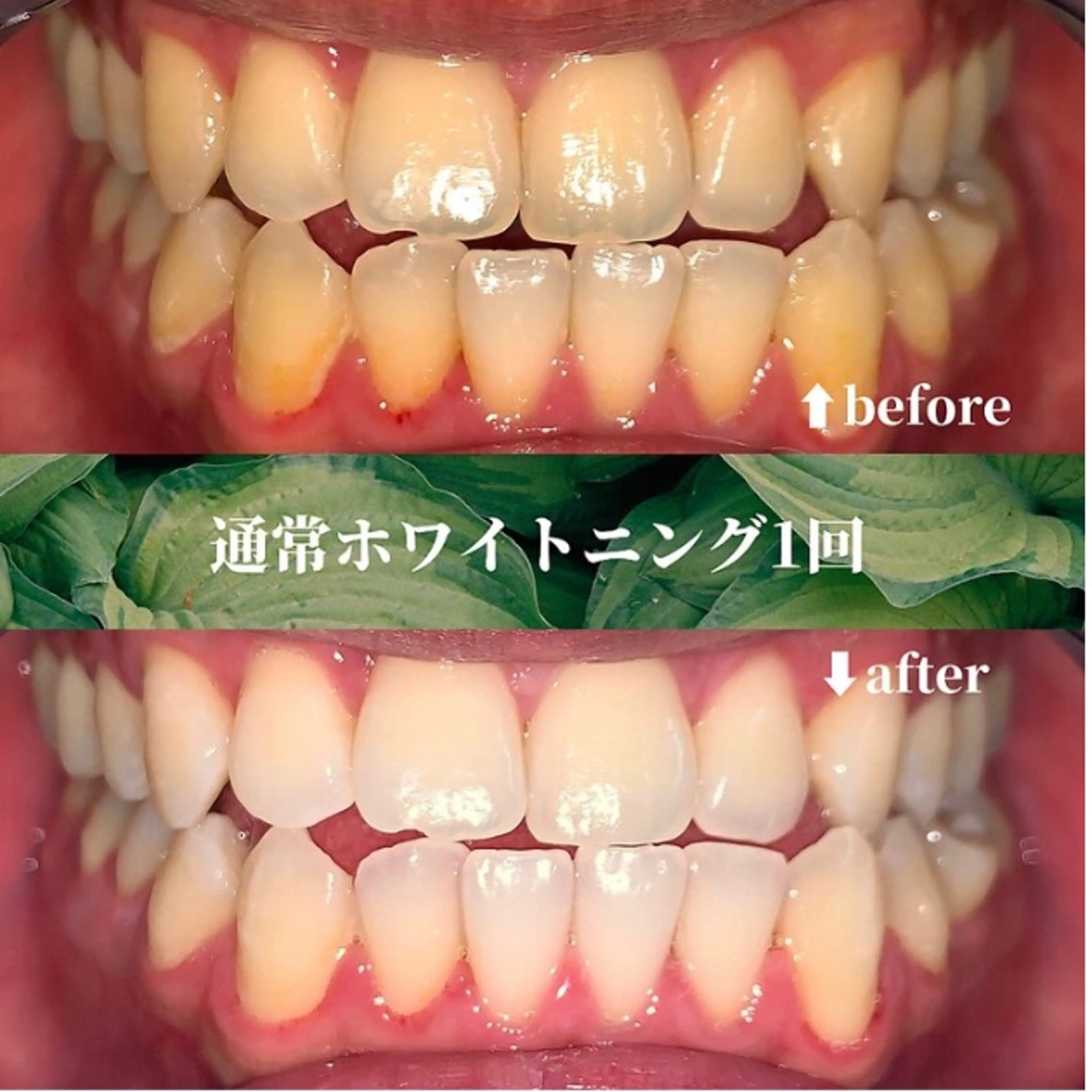 futaba ホワイトニング/天神のエステ・リラクイメージ