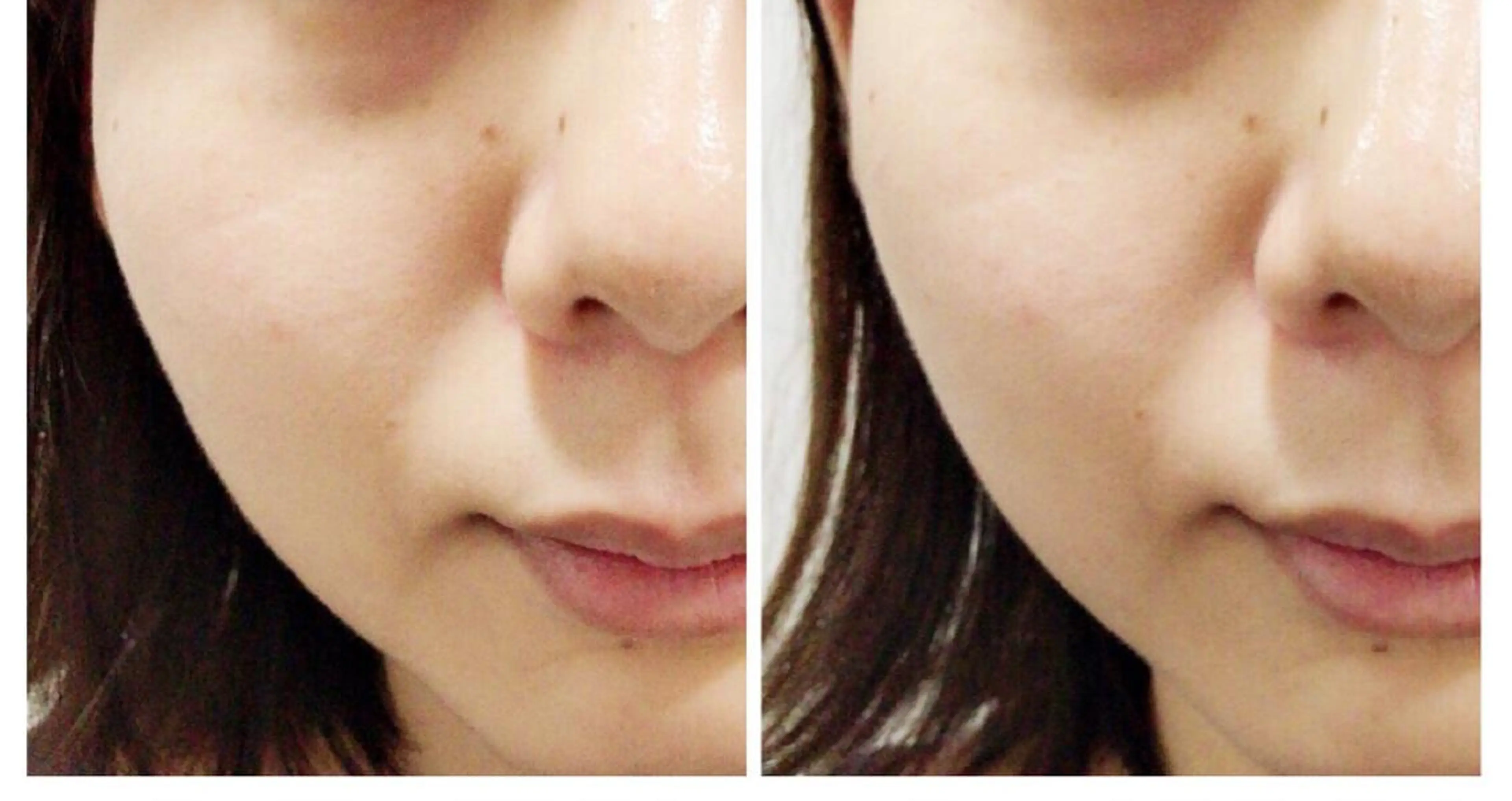 エステ リラク 武蔵浦和　小顔矯正 リーフ　　武蔵浦和店のエステ・リラクイメージ