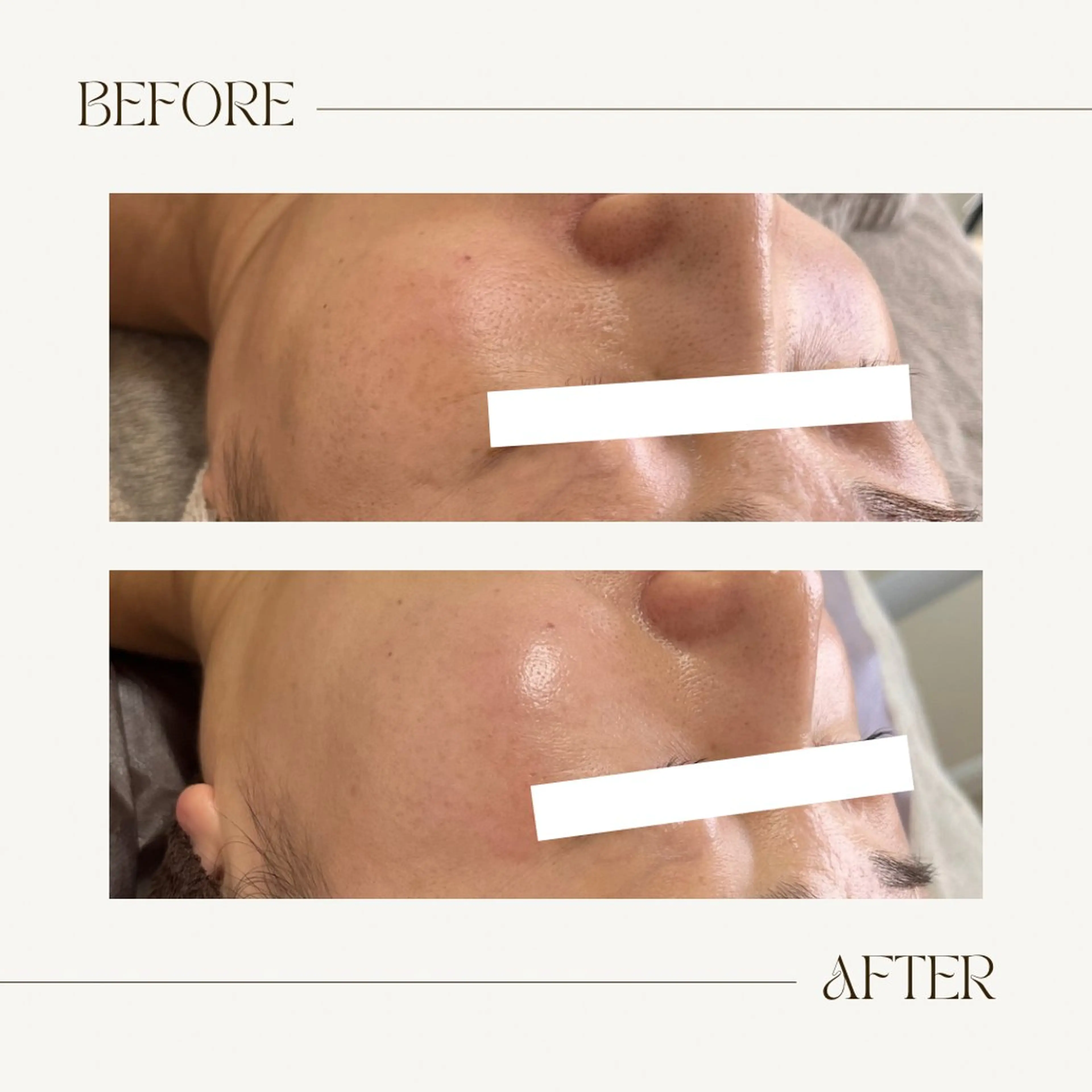 エステ 1st｜フェイシャル エステ専門店のエステ・リラクイメージ