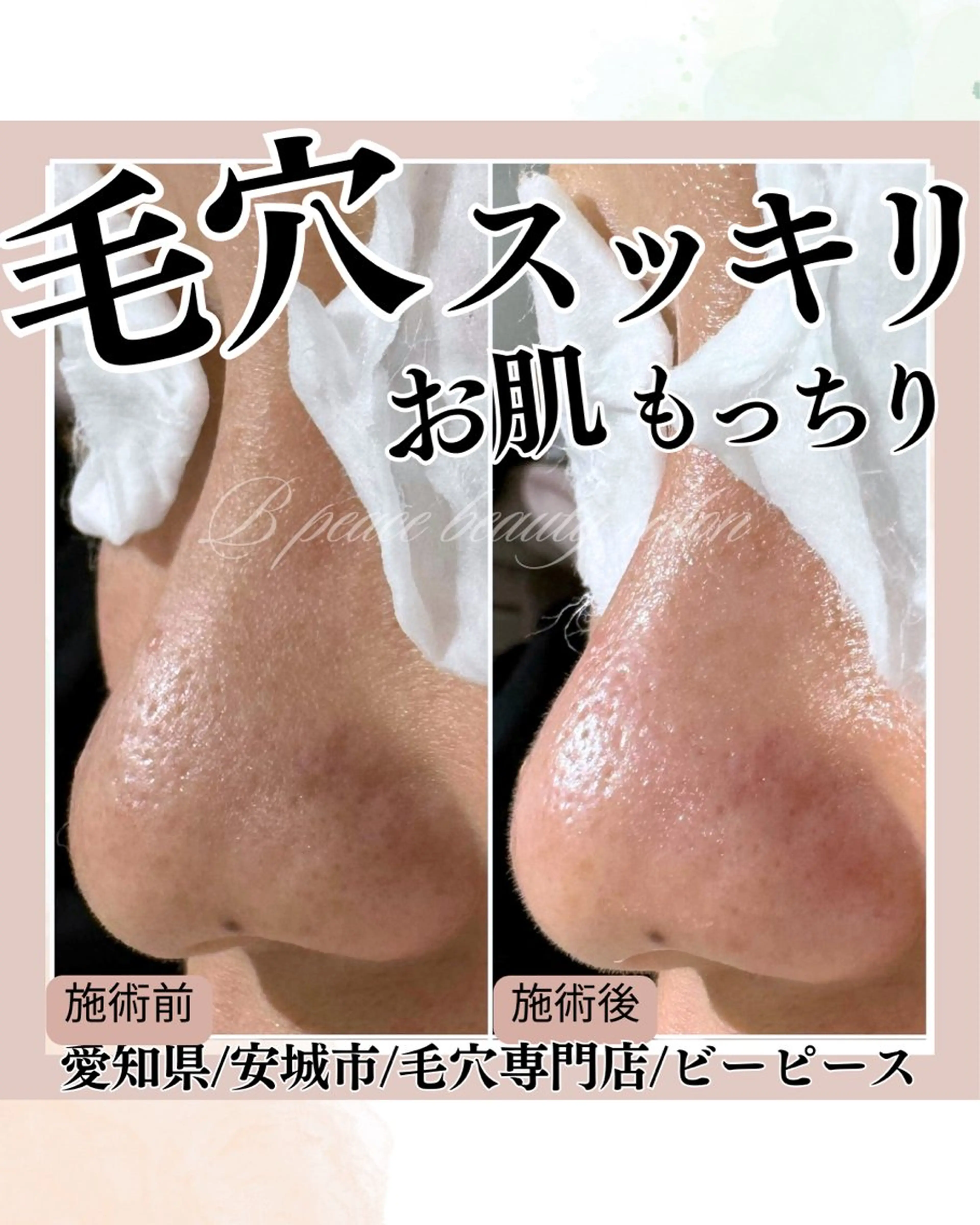 B peace beauty salon所属・B peace. はるかのマツエク・マツパデザイン