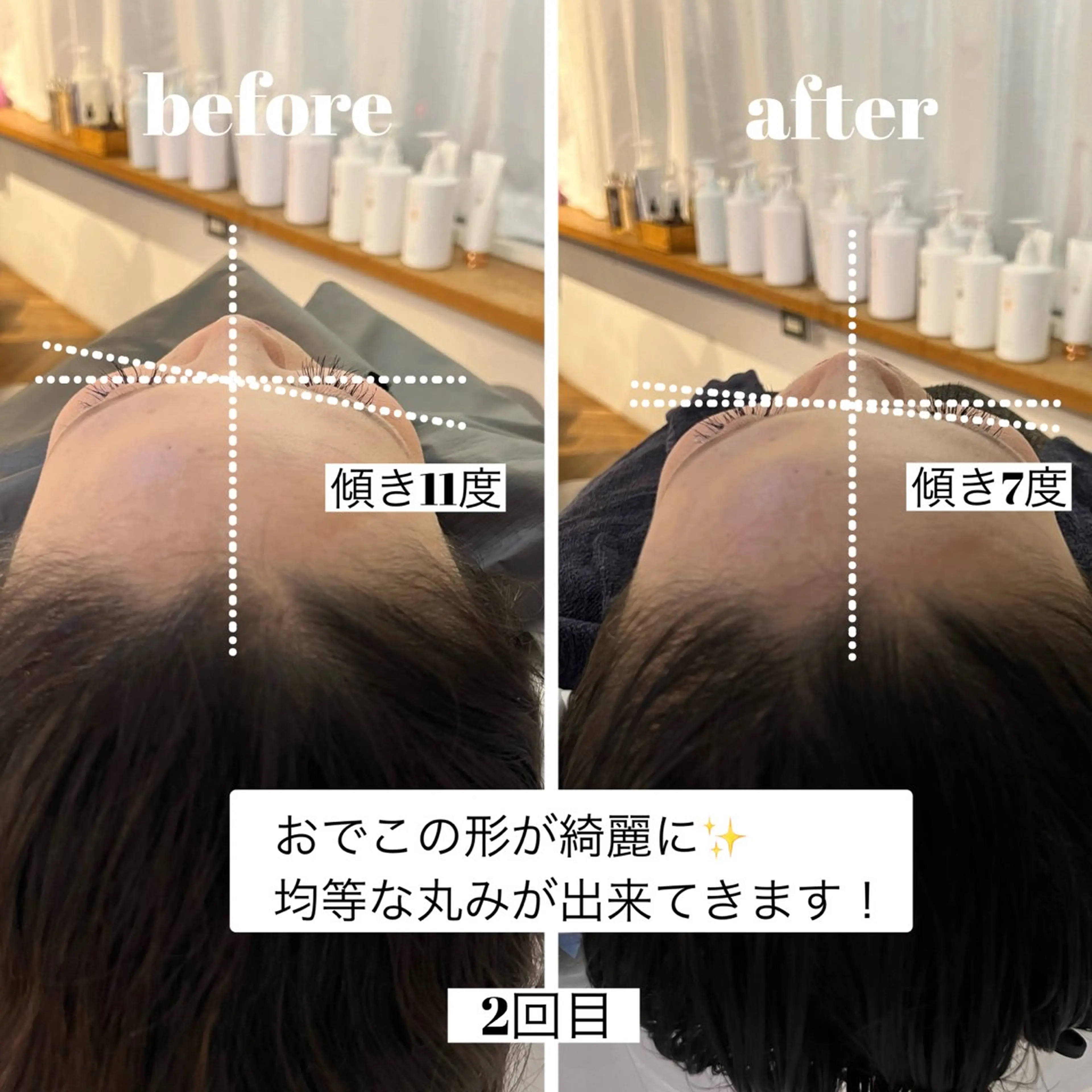 MOE/自分史上最高 カワイイ髪に💗✨のヘアスタイル