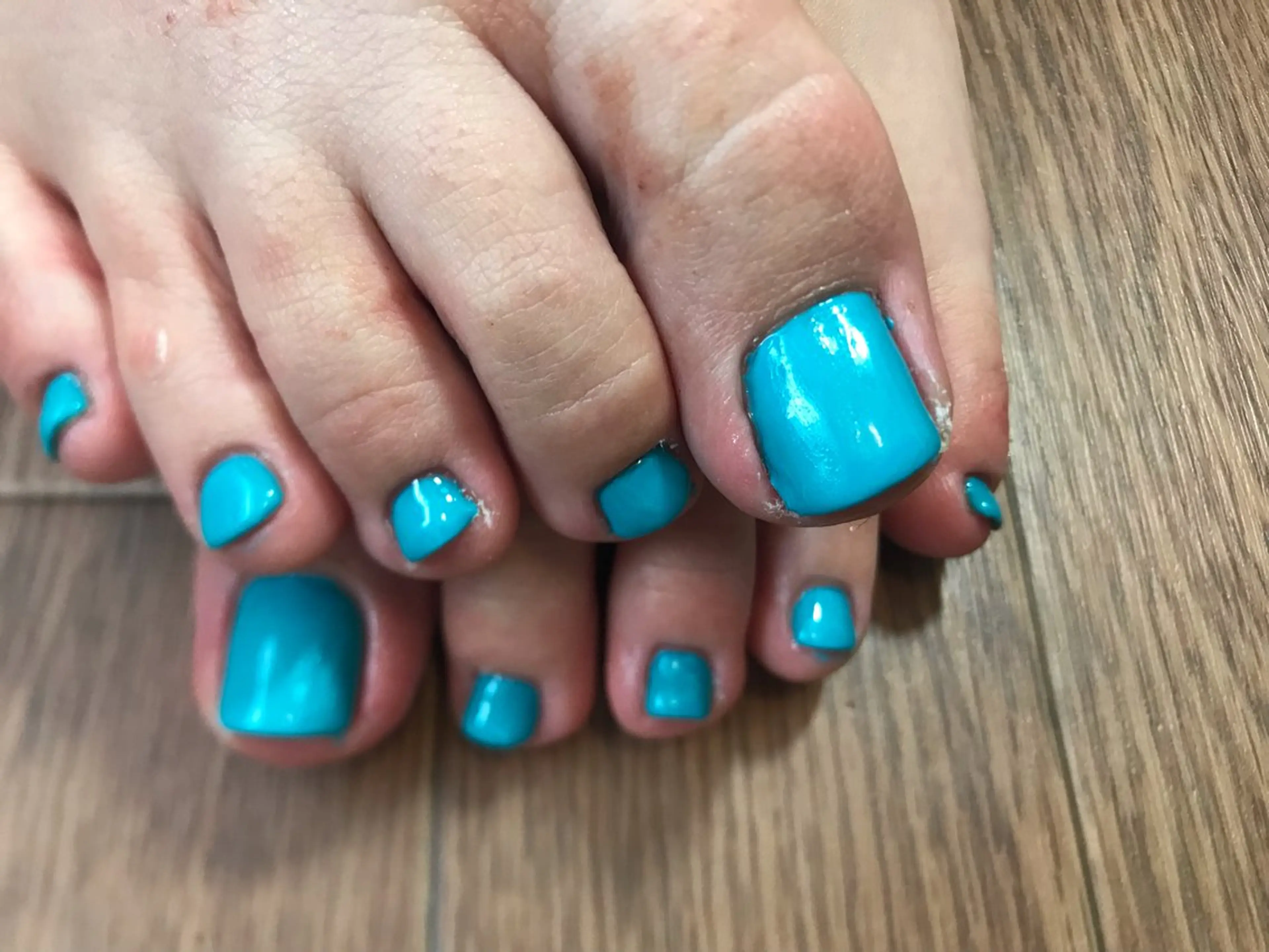 ネイル フットネイル Nailist Missaのネイルデザイン