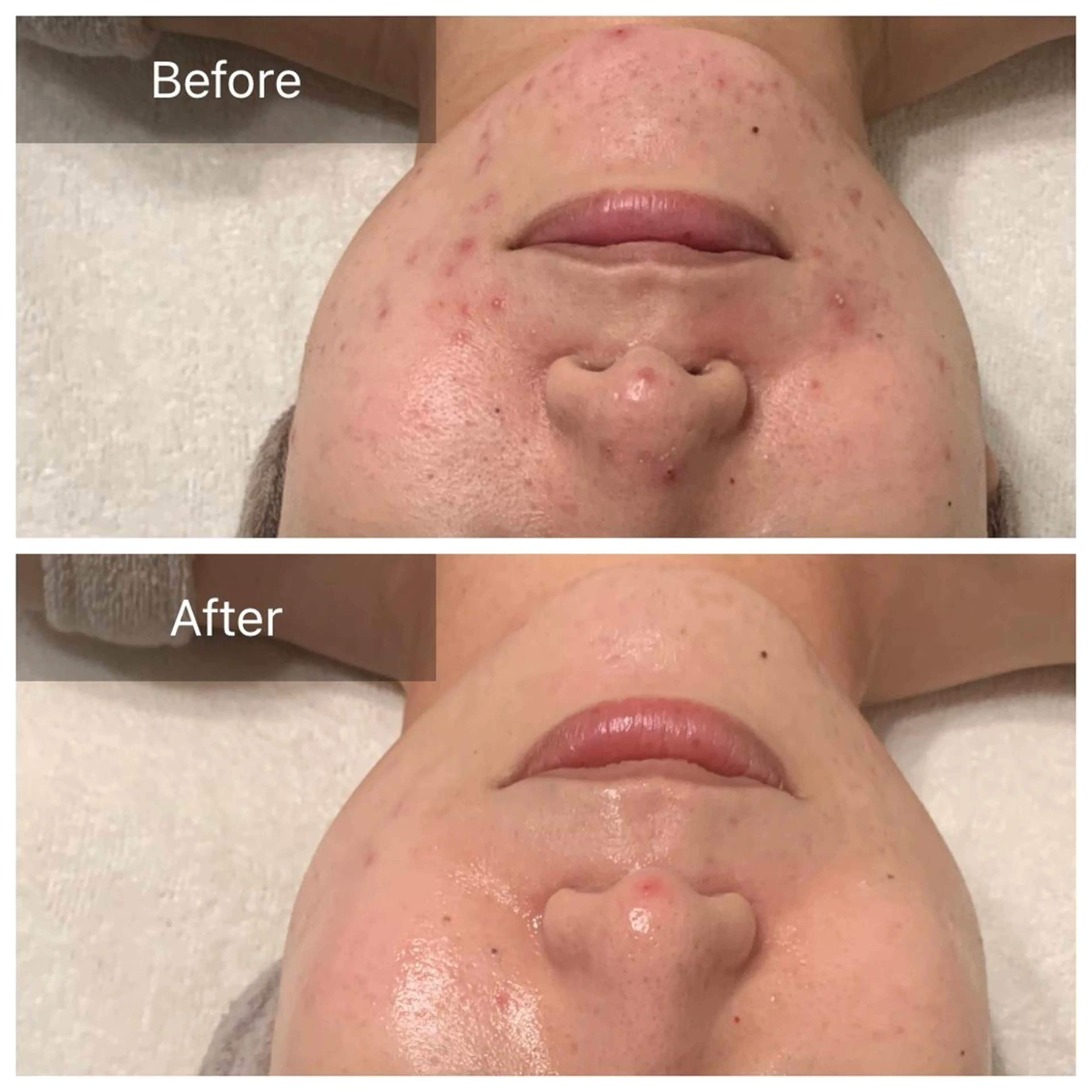 エステ Charis エステ&ネイルのエステ・リラクイメージ