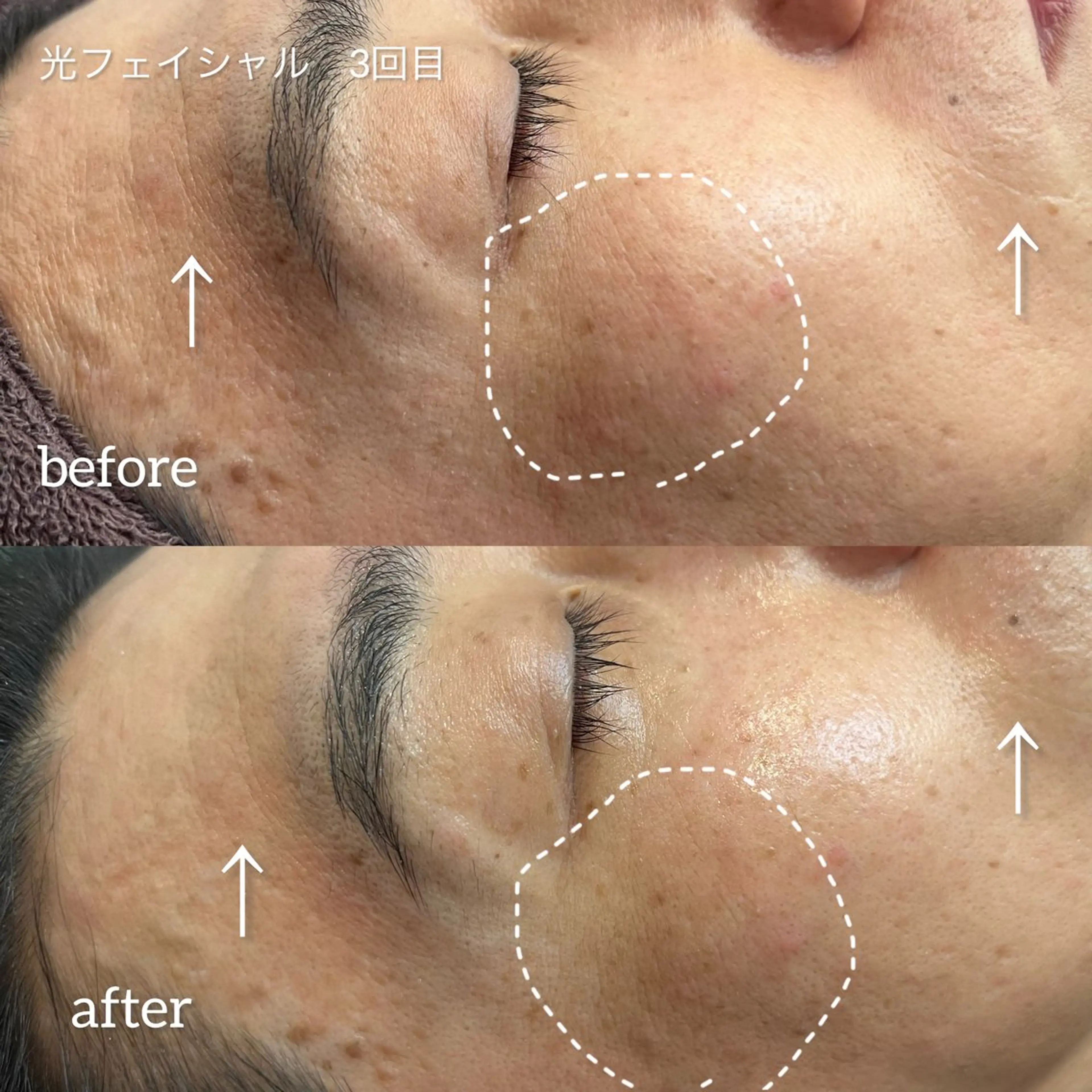 【PourVous】 AYUMIのネイルデザイン