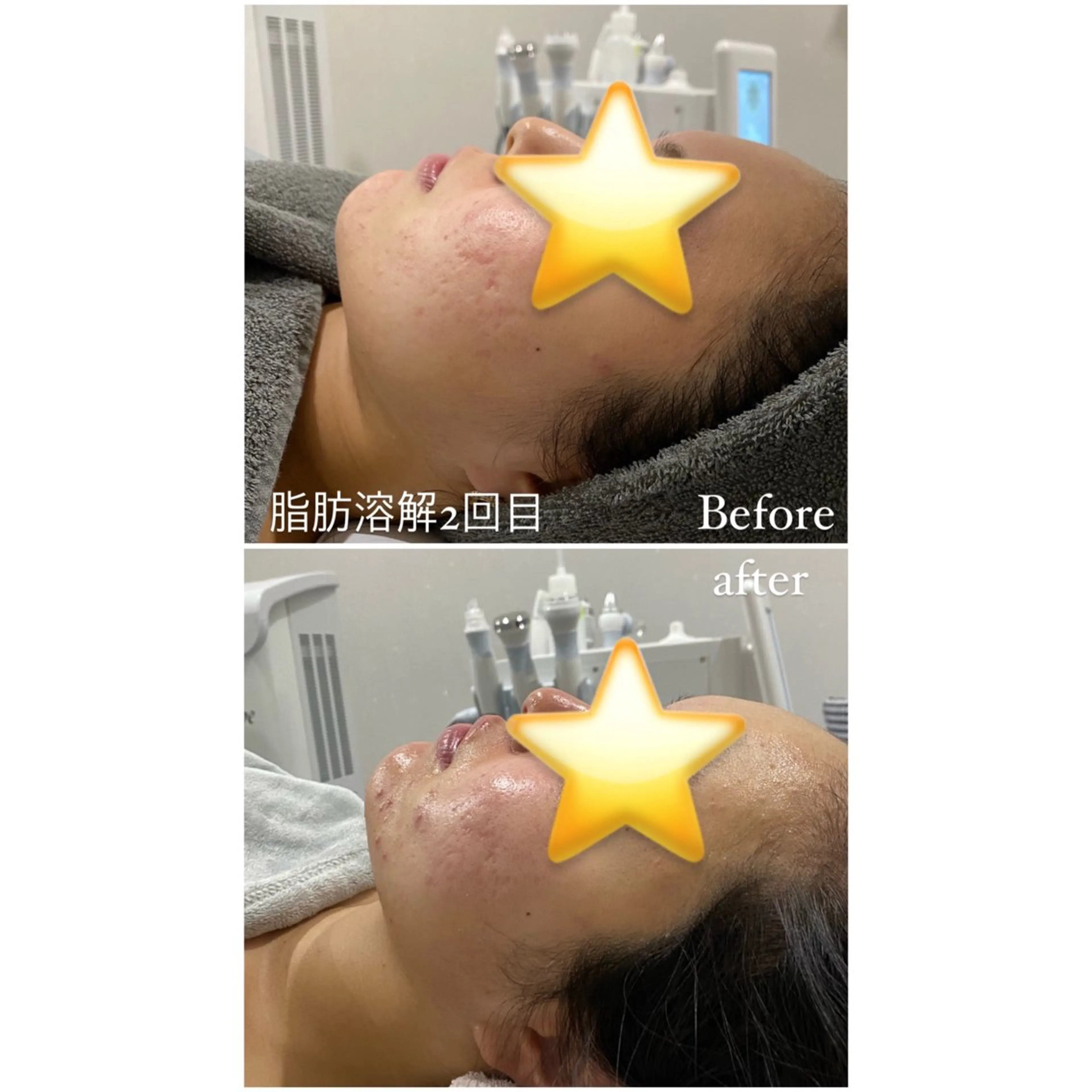 エステ 毛穴洗浄・痩身・脱毛 /アルカンジュのエステ・リラクイメージ