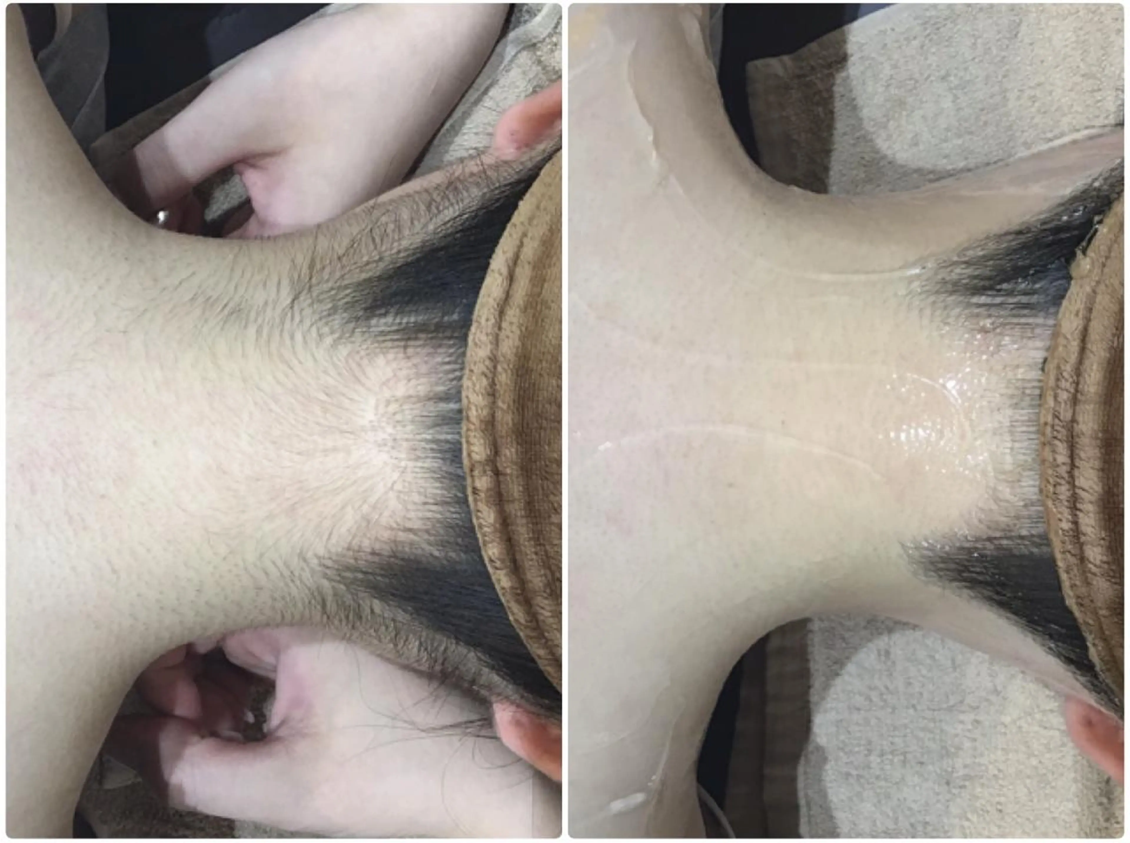 脱毛 👑Linolaby RAYVIS👑🌼のエステ・リラクイメージ