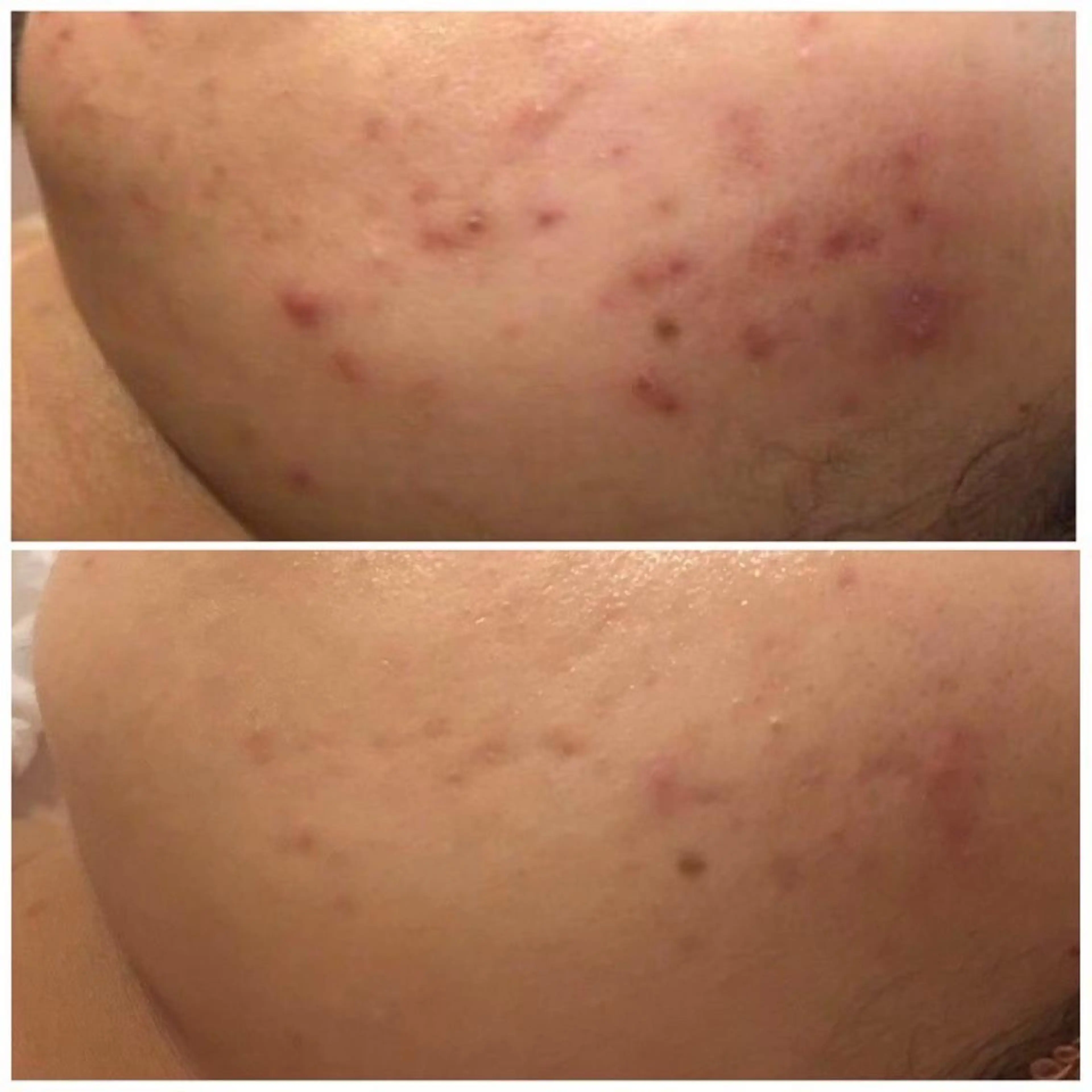 セミロング カラー パーマ ヘアアレンジ メンズ キッズ ネイル マツエク・マツパ アイブロウ ニキビ特化型エステ 🍓最短で肌質改善のその他イメージ