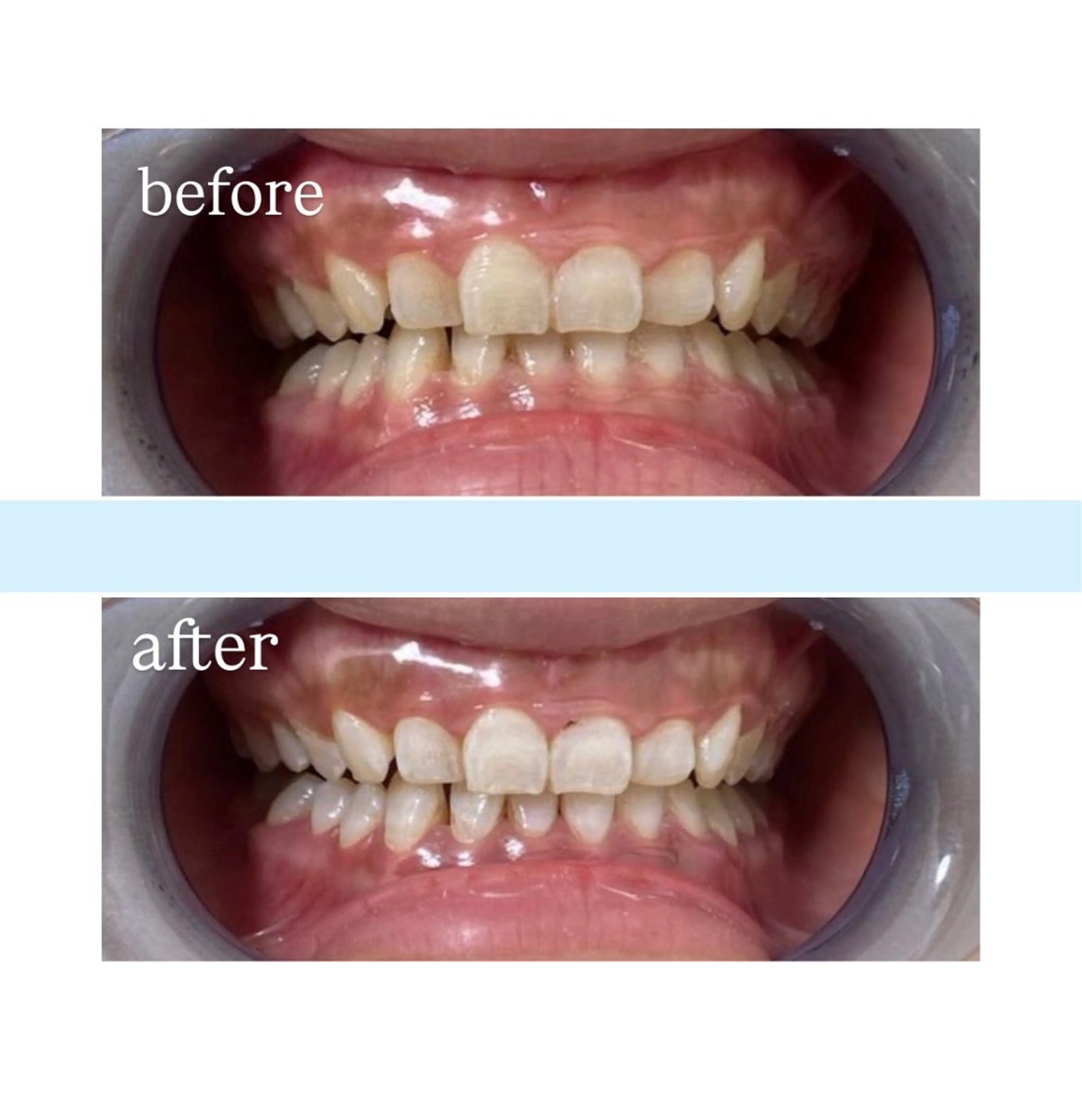 メンズ MiraeWhite所属・くるみ 🦷✨のその他イメージ